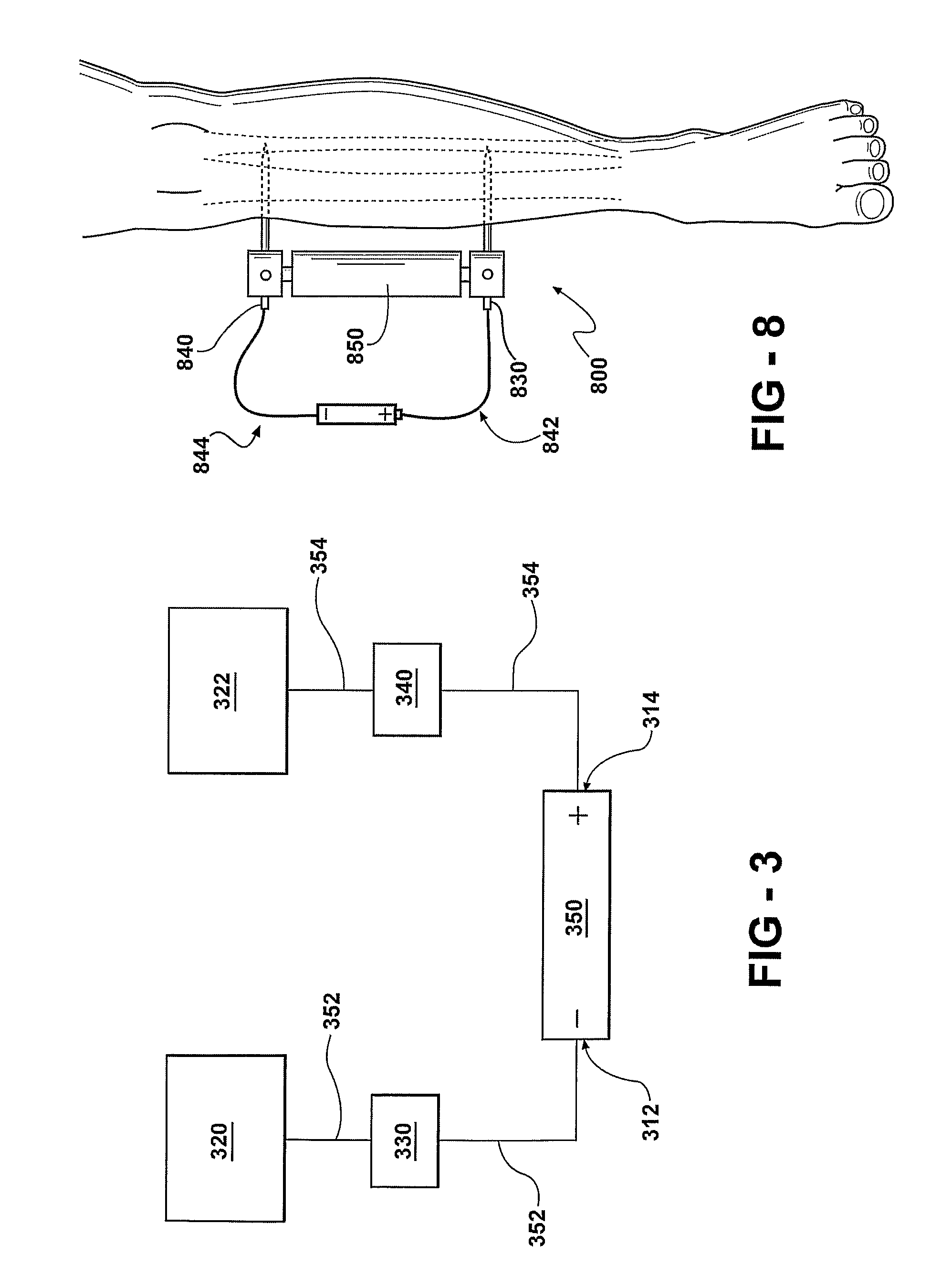 Prophylactic Bactericidal Implant