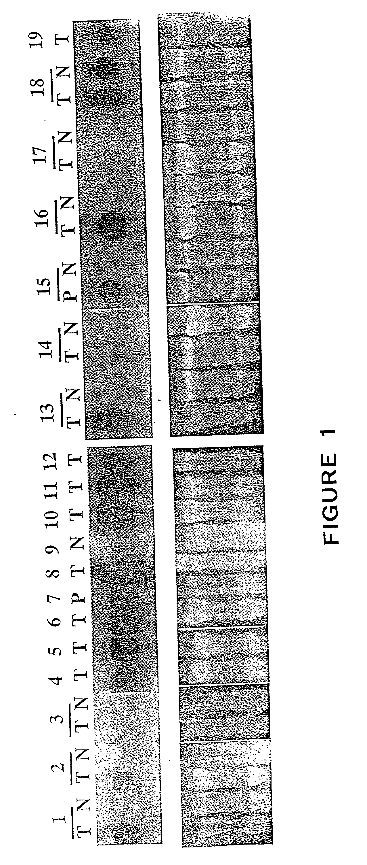 Methods and compositions for diagnosis and treatment of cancer