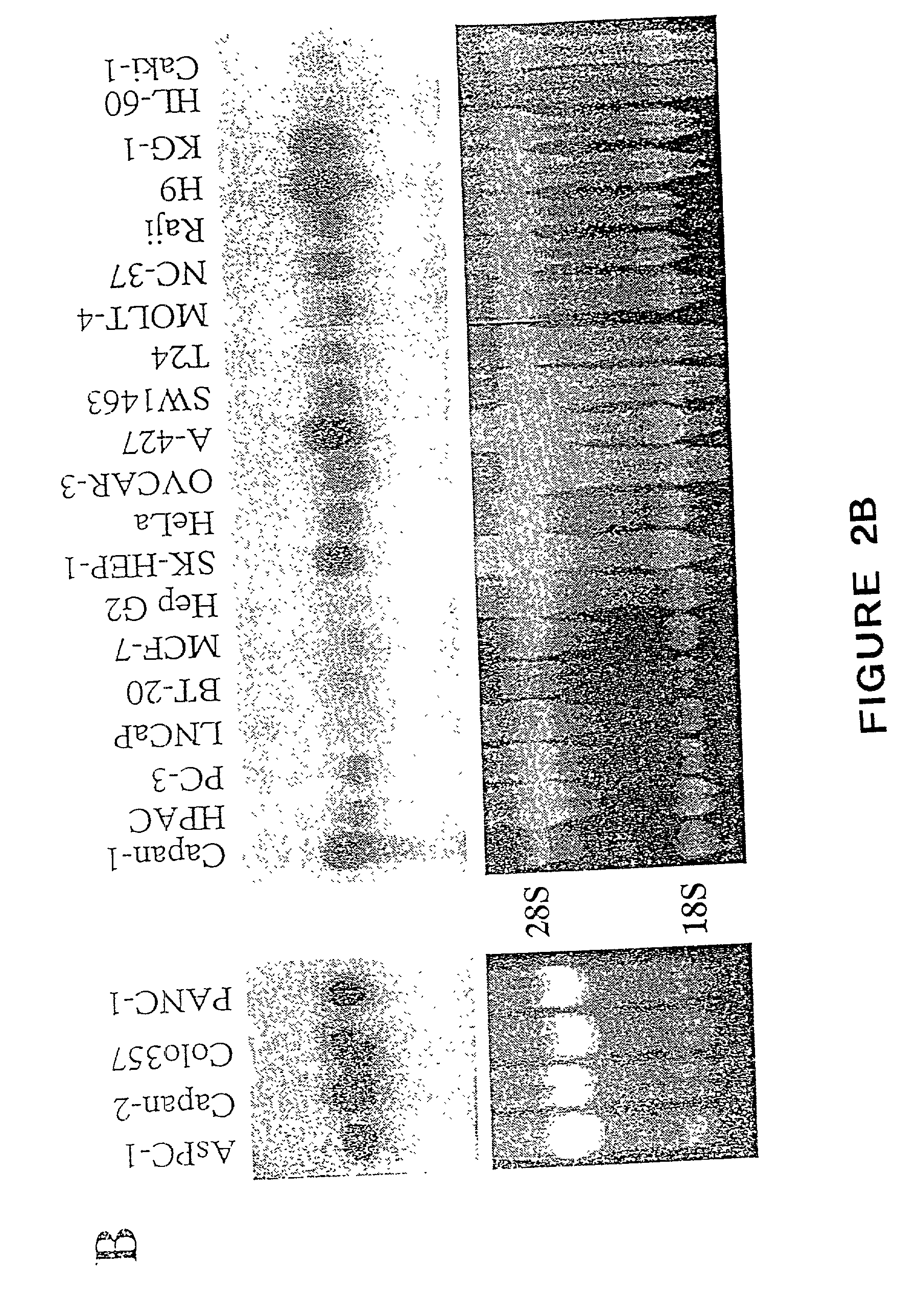 Methods and compositions for diagnosis and treatment of cancer