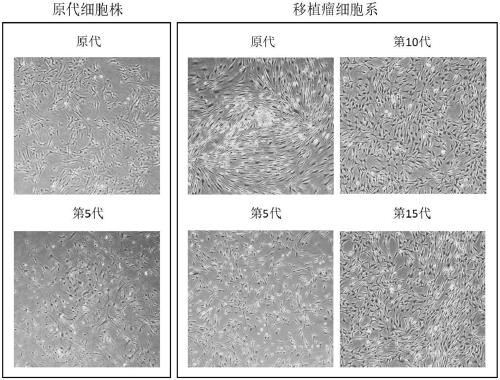 NF2-/- vestibular schwannoma Schwann cell line and establishment method thereof