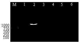 Degenerate primer and method of detecting Y potyvirus virus of potato by using degenerate primer