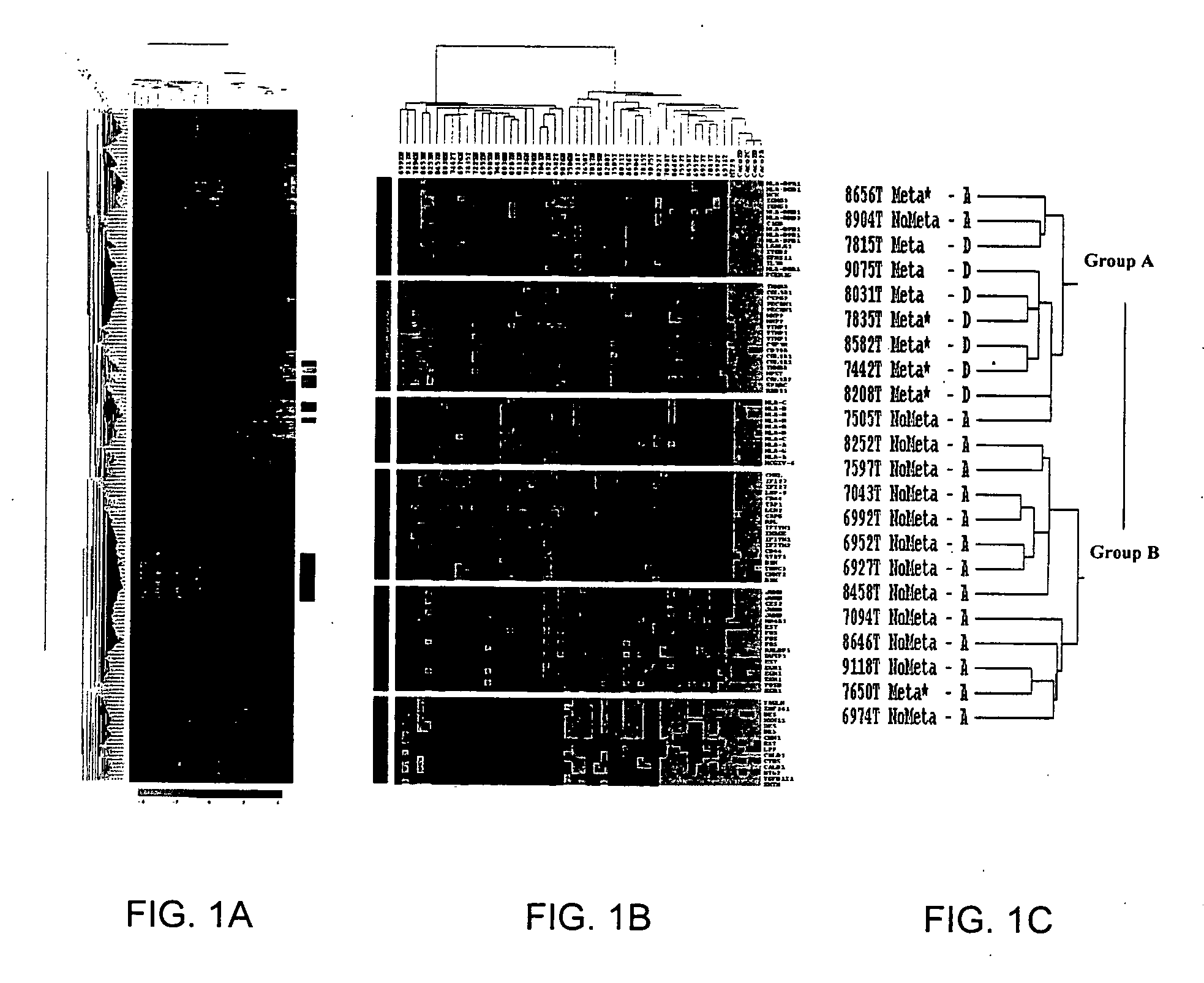 Gene expression profiling of colon cancer with DNA arrays