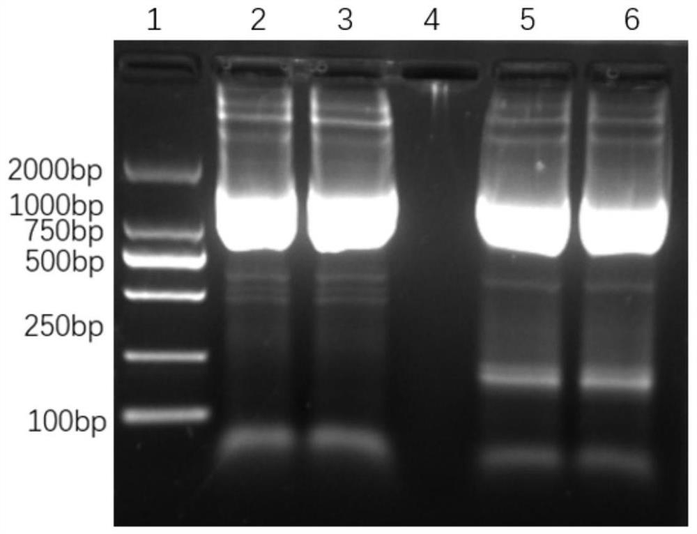 Chimeric antigen receptor capable of simultaneously targeting CD19 and CD20 and application of chimeric antigen receptor