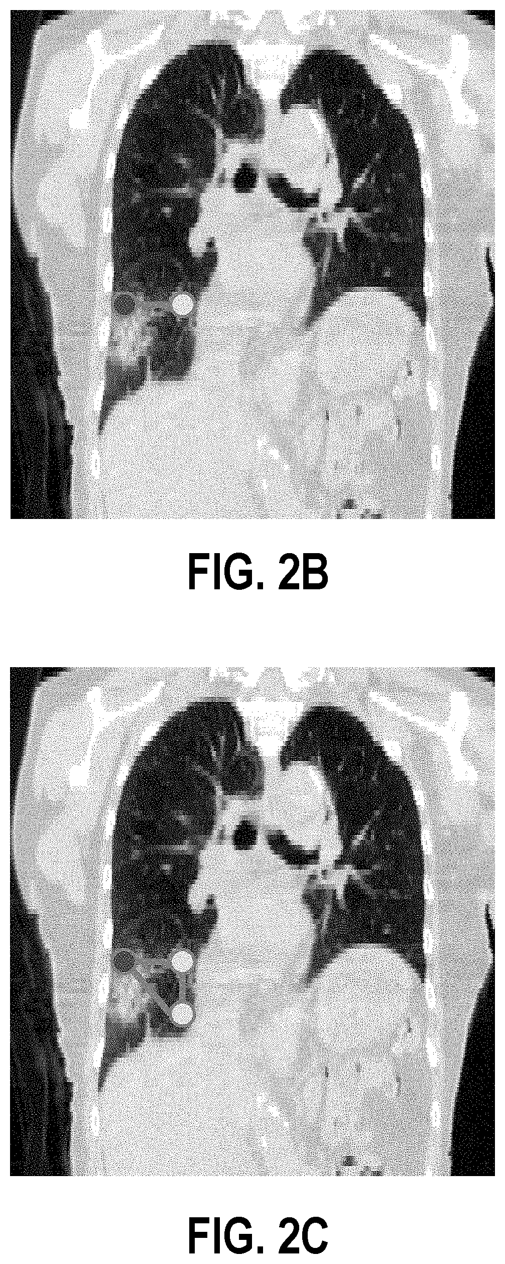 Accurate detection and assessment of radiation induced lung injury based on a computational model and computed tomography imaging