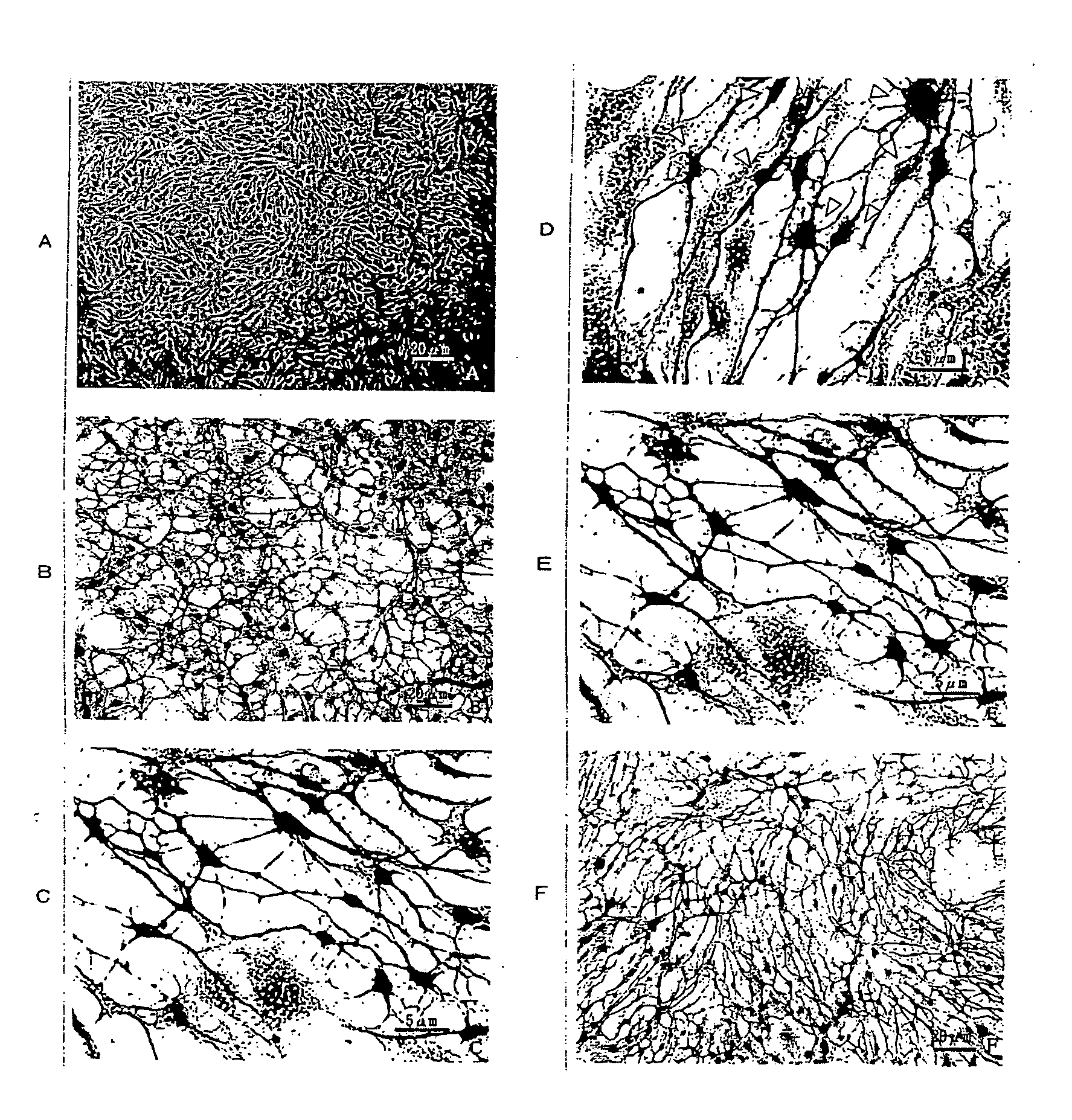 Differentiated Cells Originating in Precursor Fat Cells and Method of Acquiring the Same