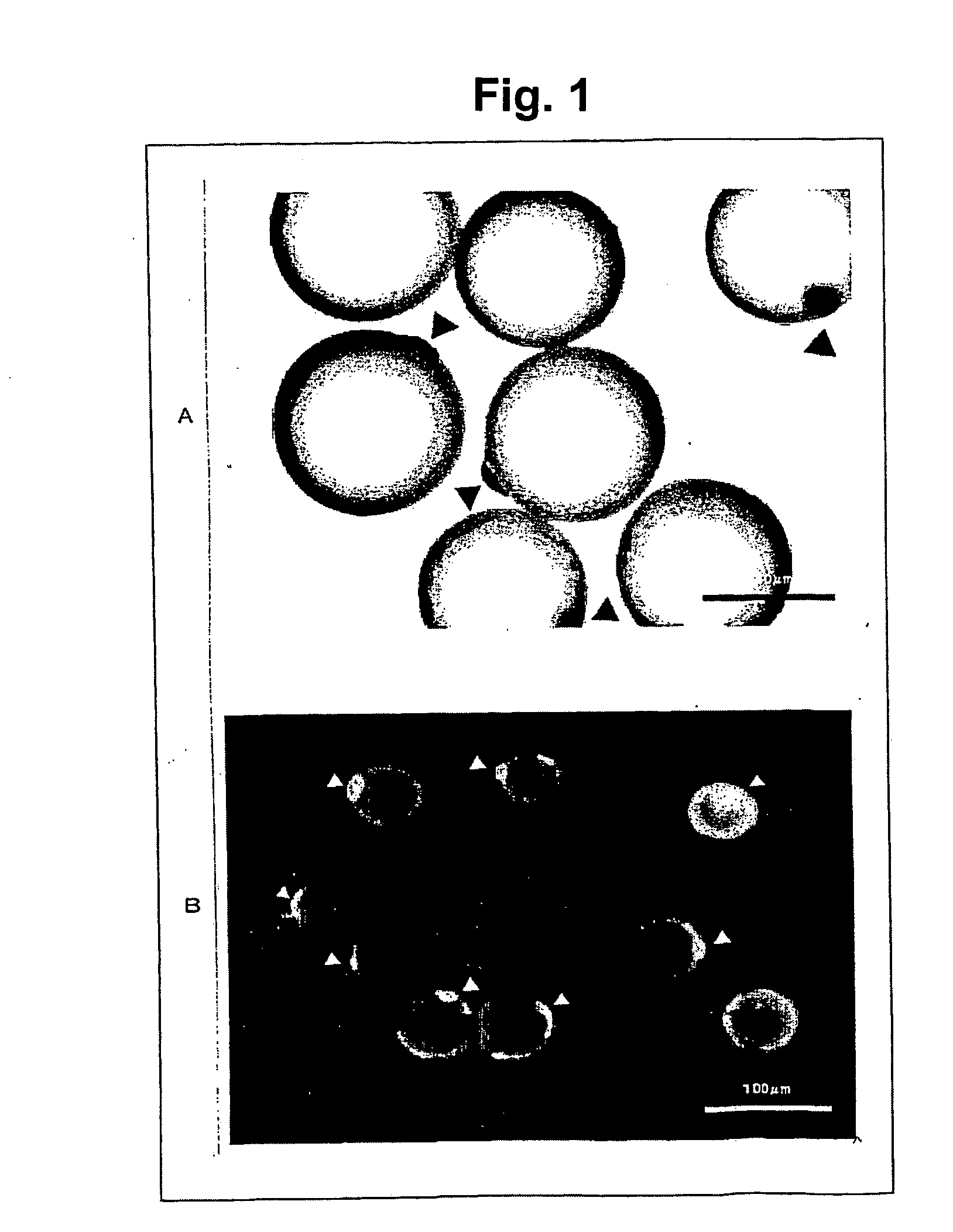 Differentiated Cells Originating in Precursor Fat Cells and Method of Acquiring the Same