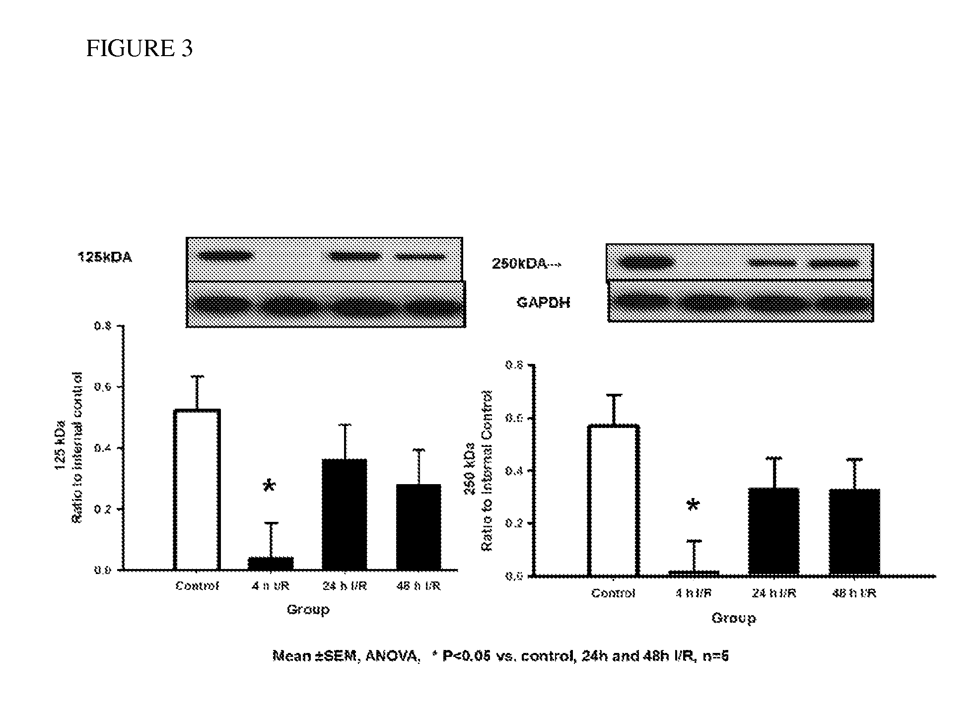 Treatment of disease using inter-alpha inhibitor proteins