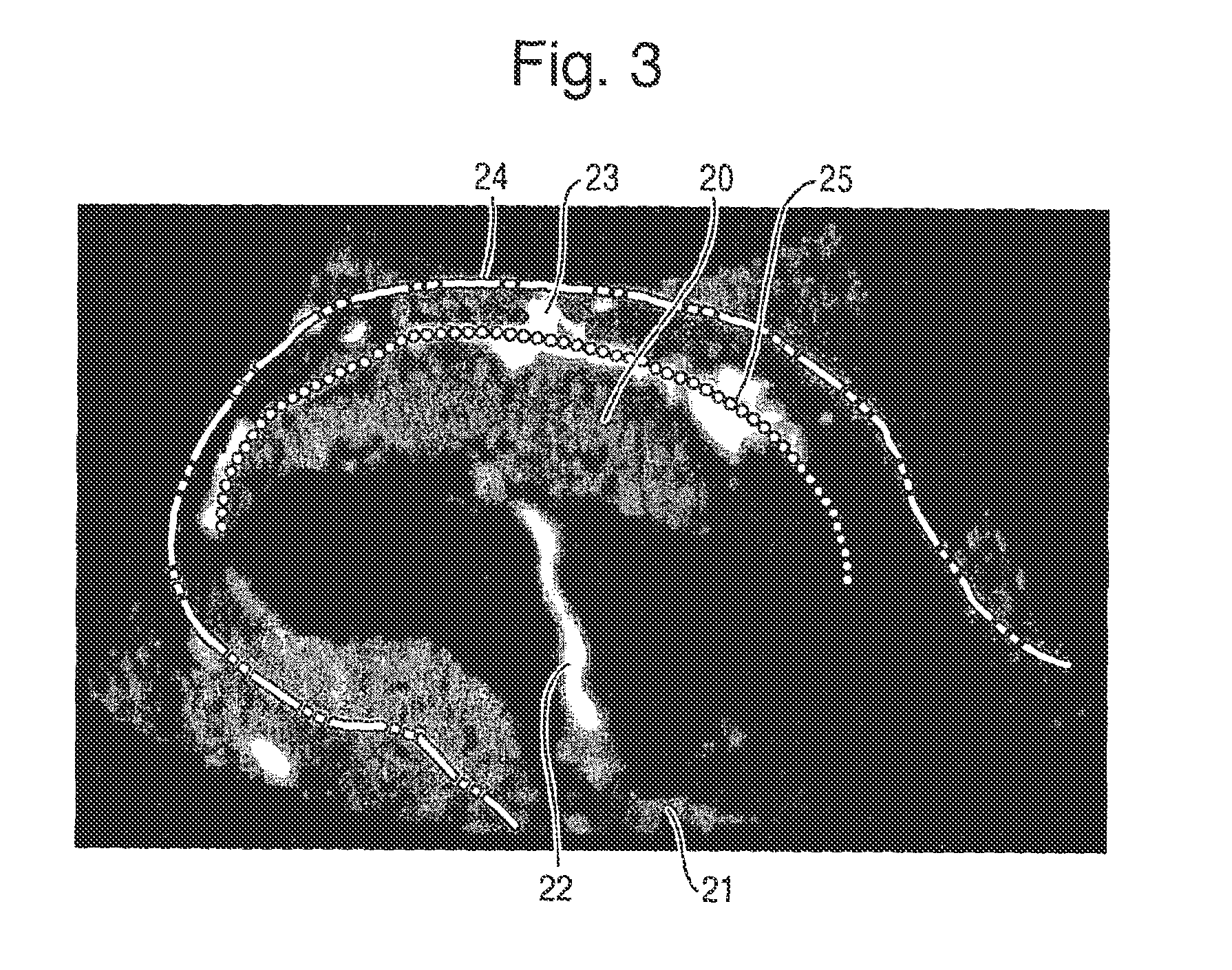 Transformation of a Three-Dimensional Flow Image