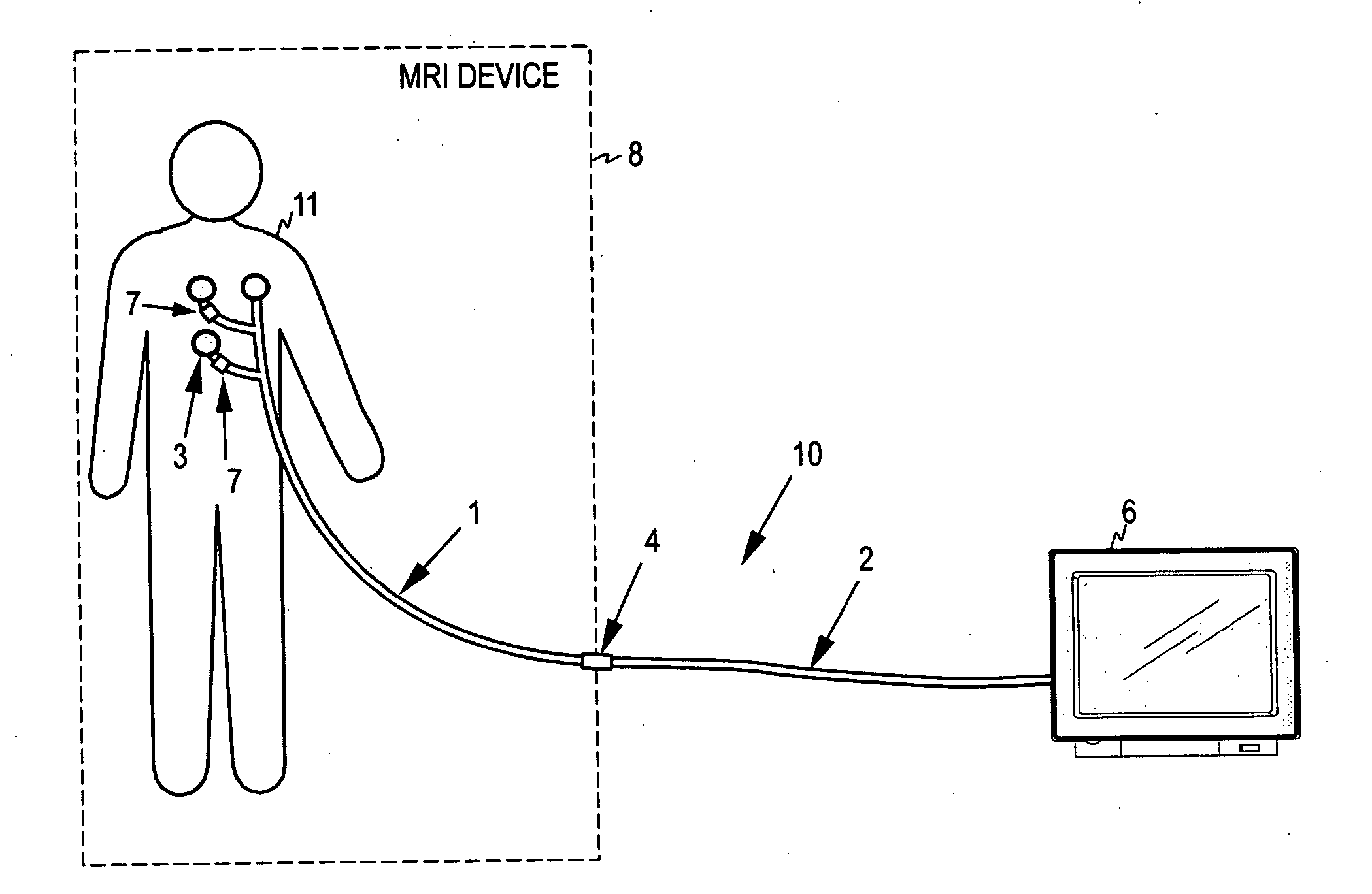 Patient cable for medical measurements