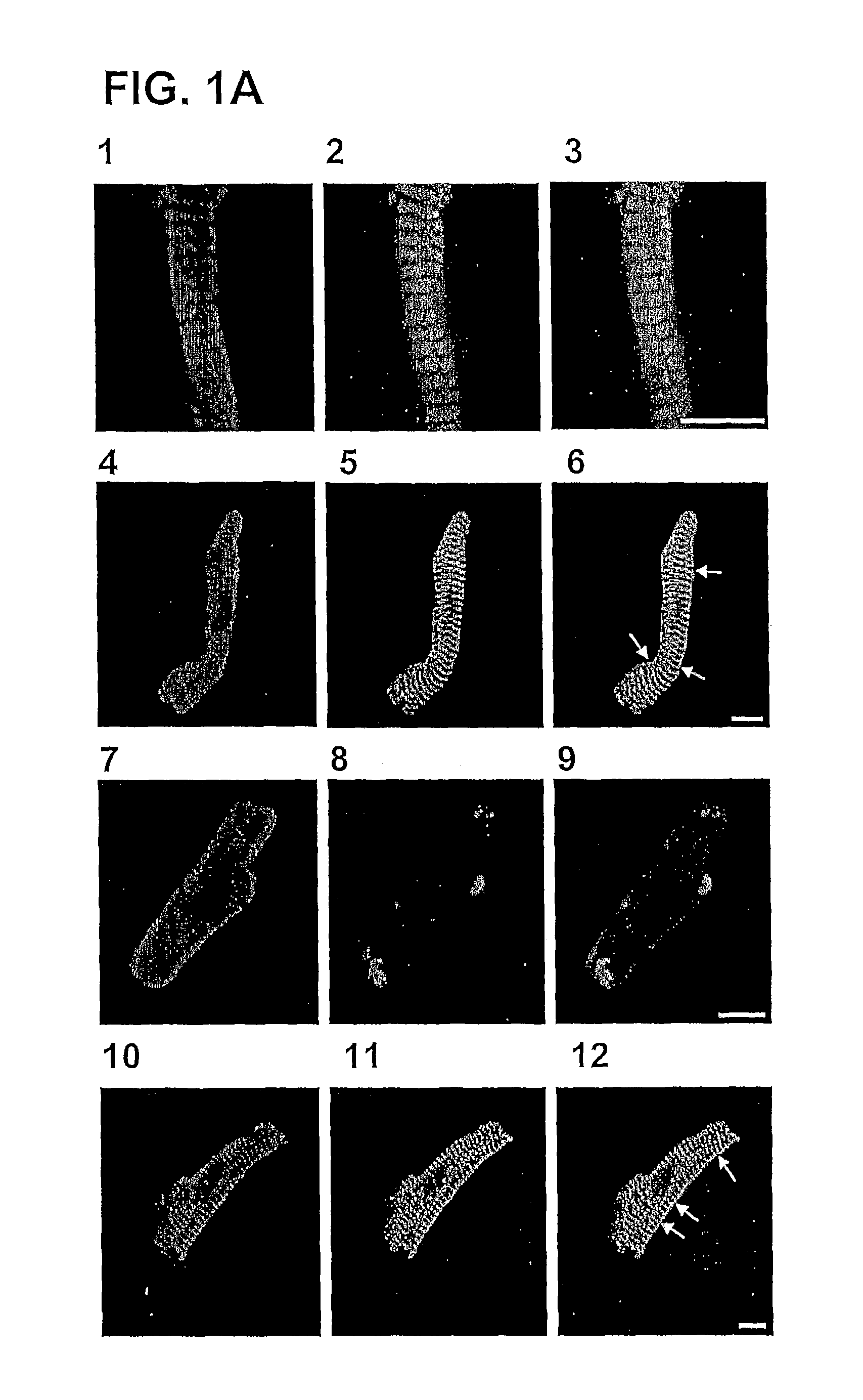 Compounds for the treatment of auricular fibrillation