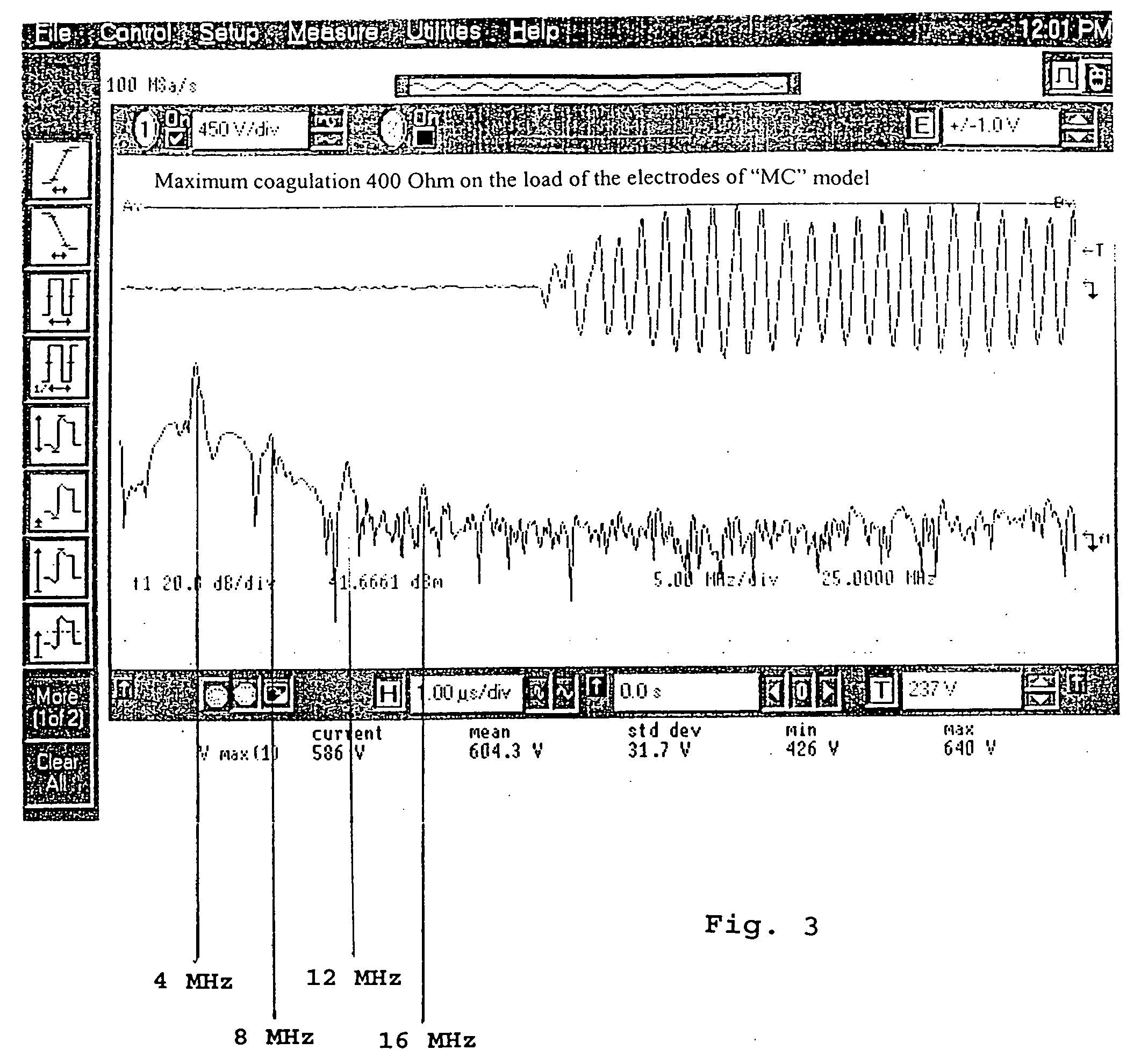 Electronic coagulation scalpel