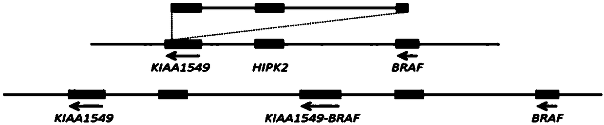 Fluorescence in situ hybridization probe for detecting KIAA1549-BRAF fusion gene and preparation method and application thereof