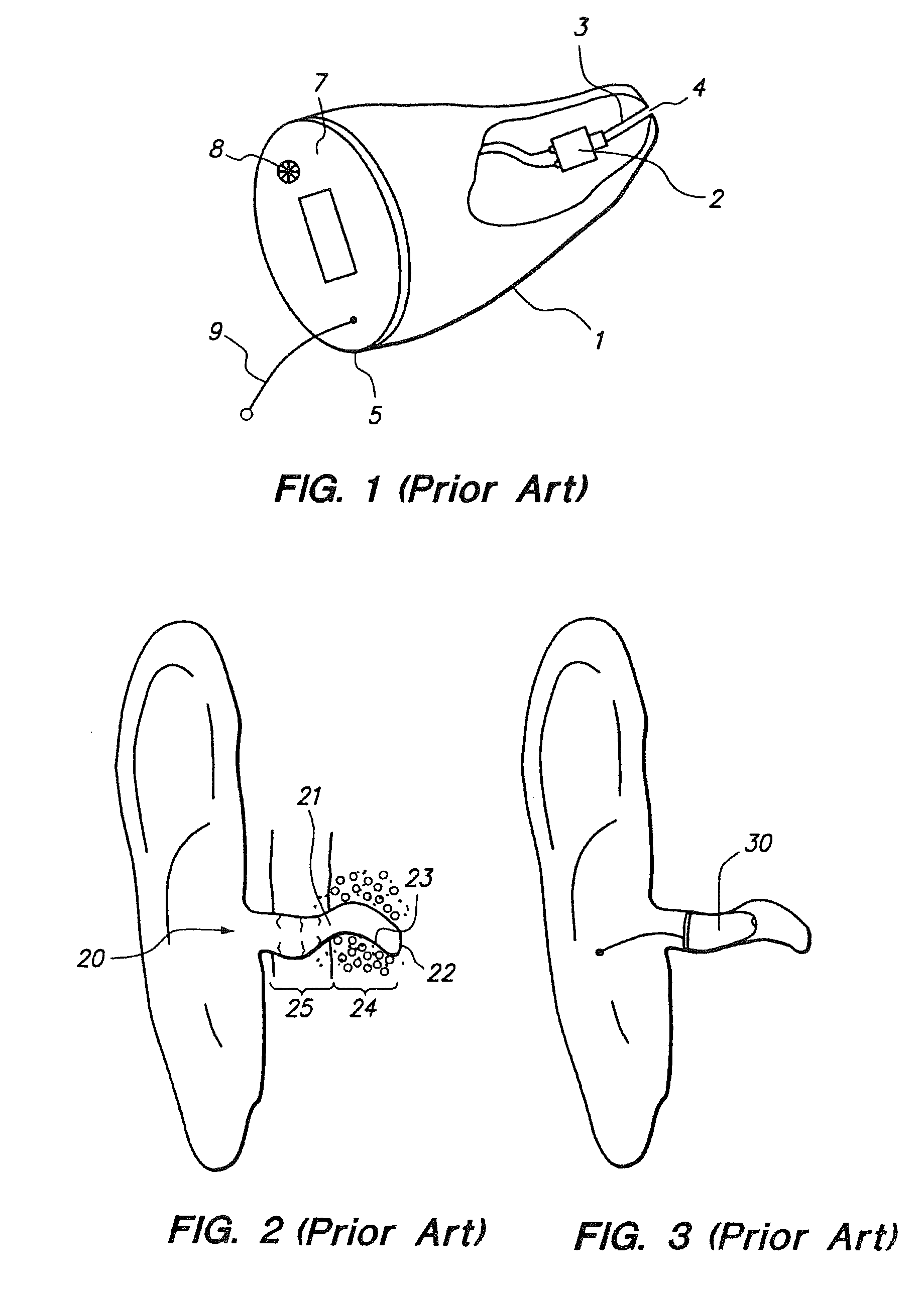 Open fit canal hearing device