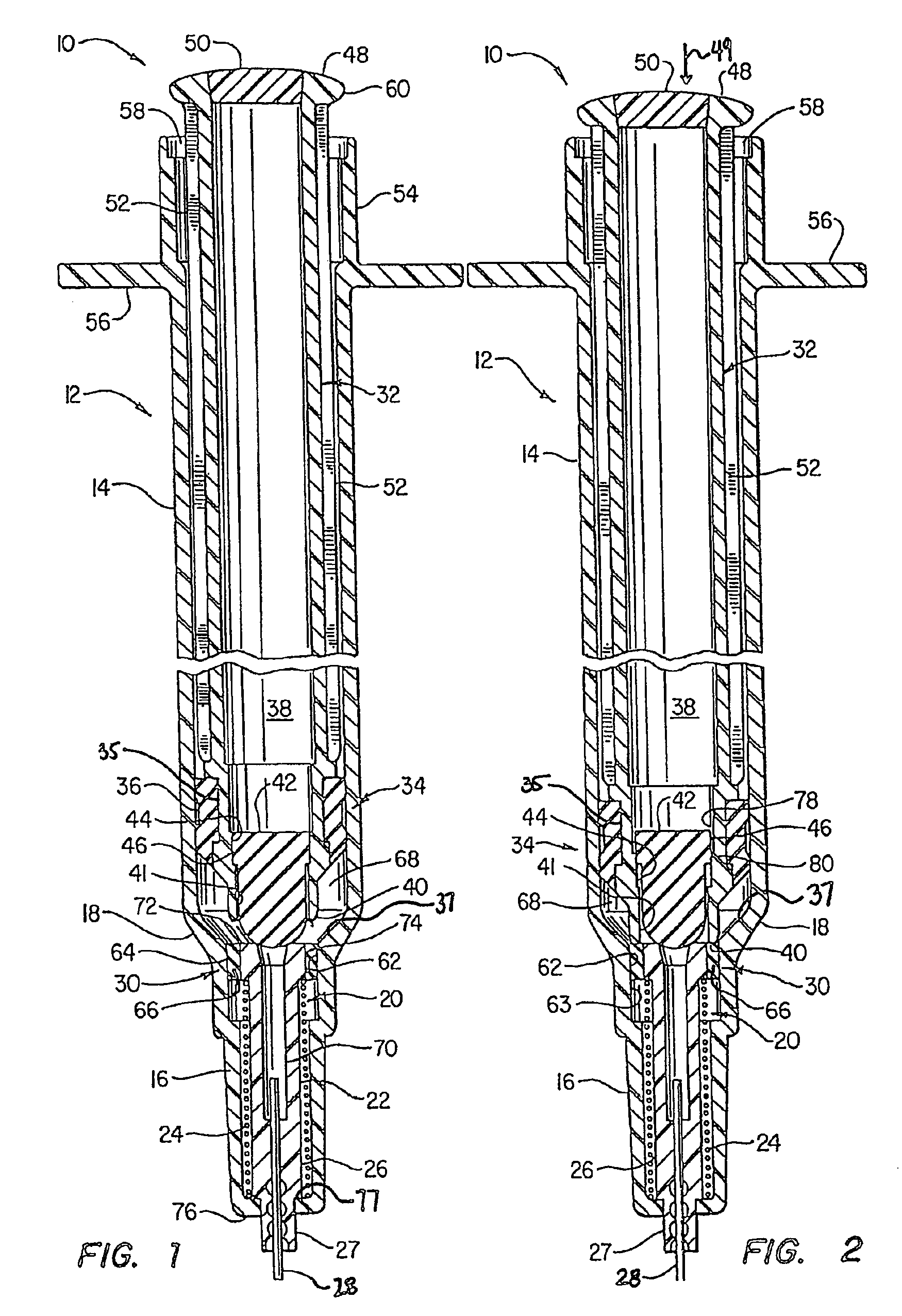 Medical Device with Retractable Needle