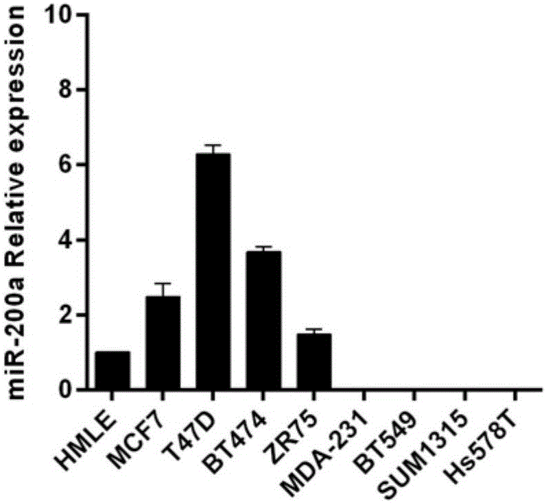 Application of composition in diagnosis of triple negative breast cancer