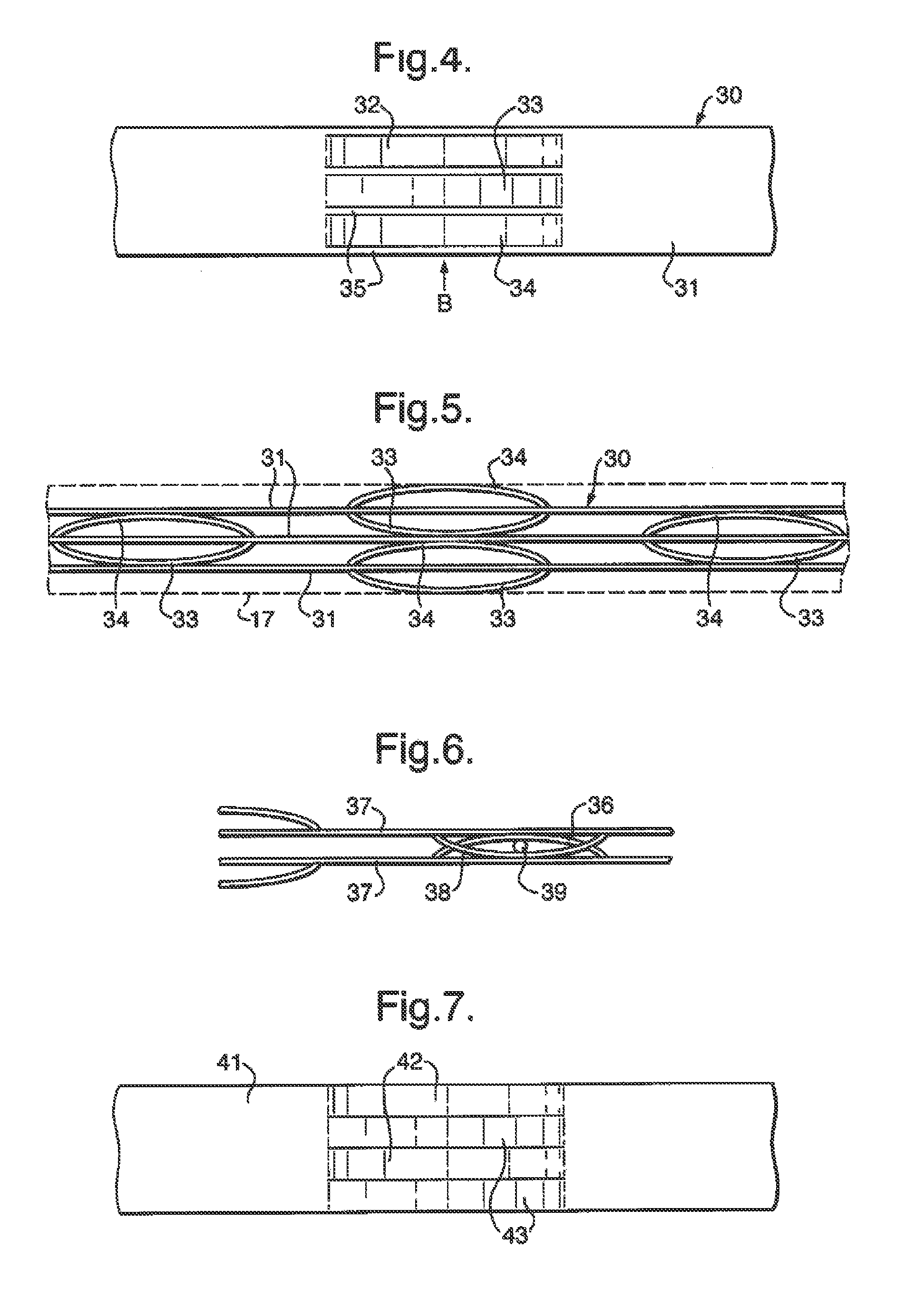 Catalytic reactors