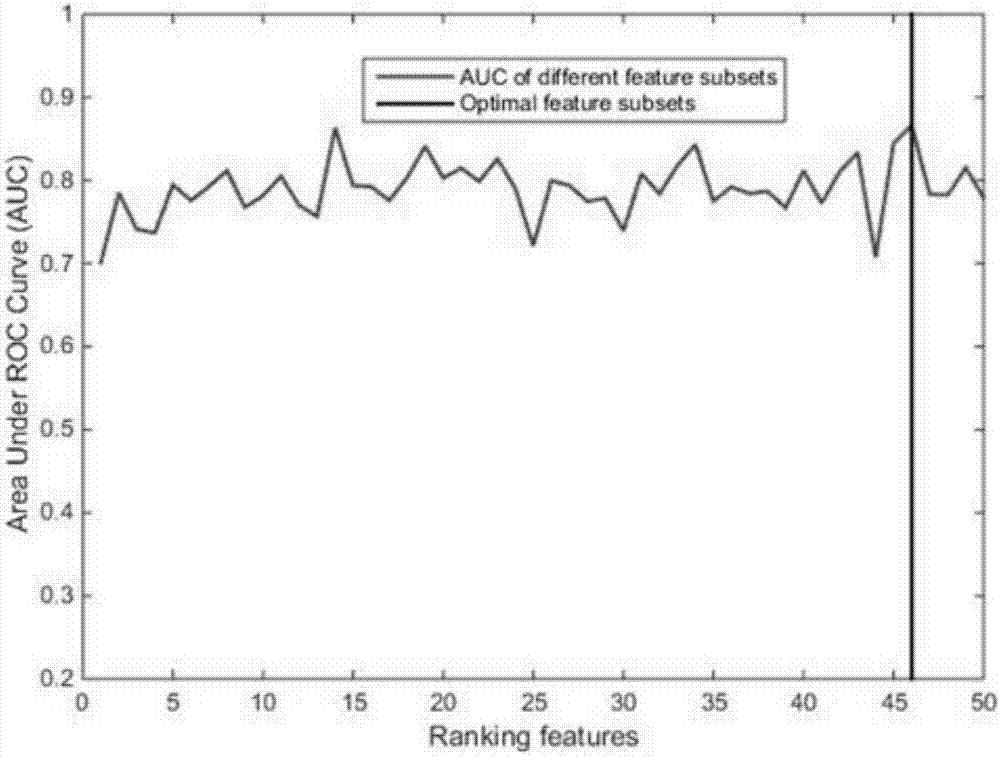 Construction method of gastrointestinal stromal tumor malignant potential classification model based on support vector machine