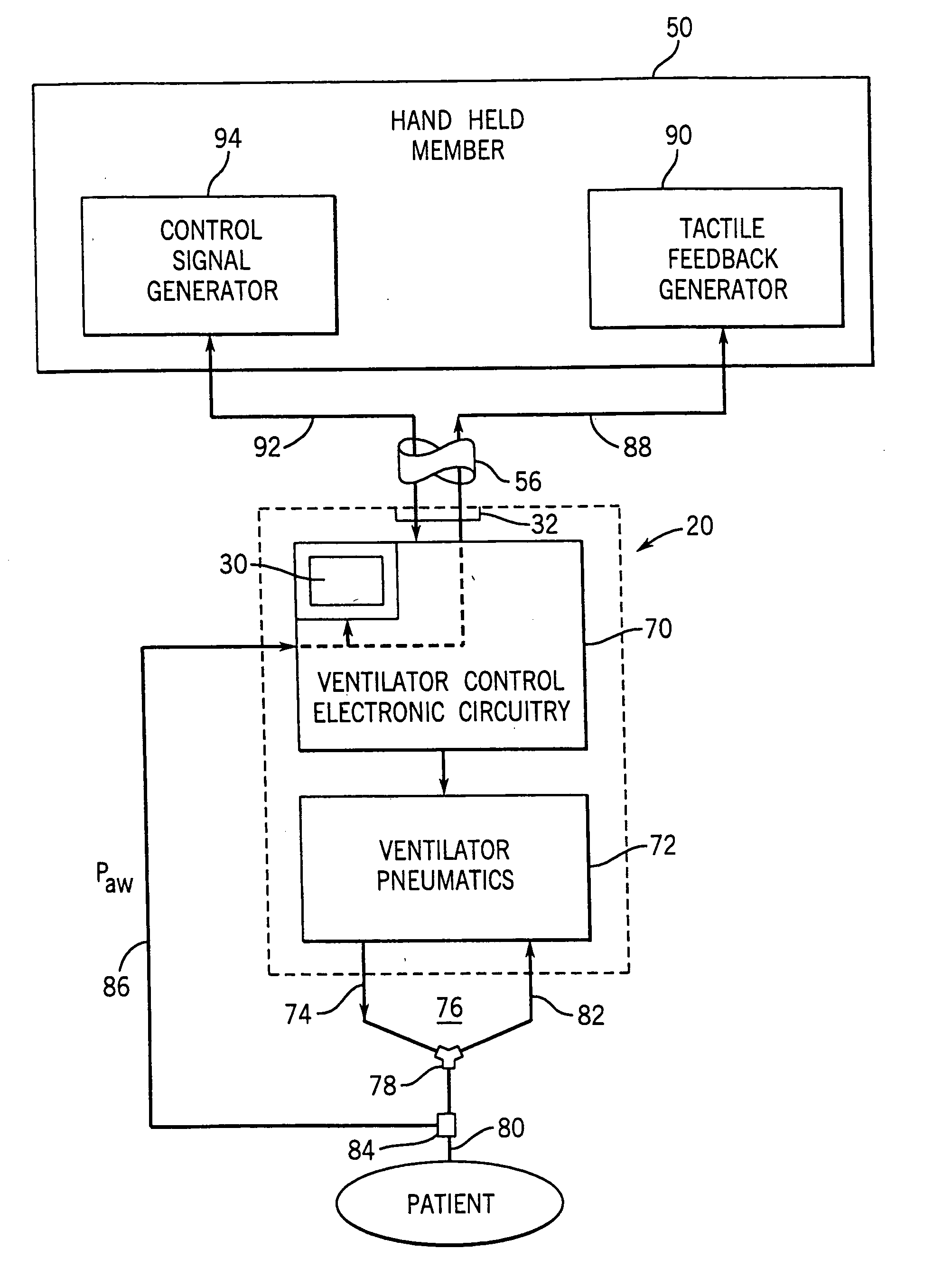 Remote control and tactile feedback system and method for medical apparatus