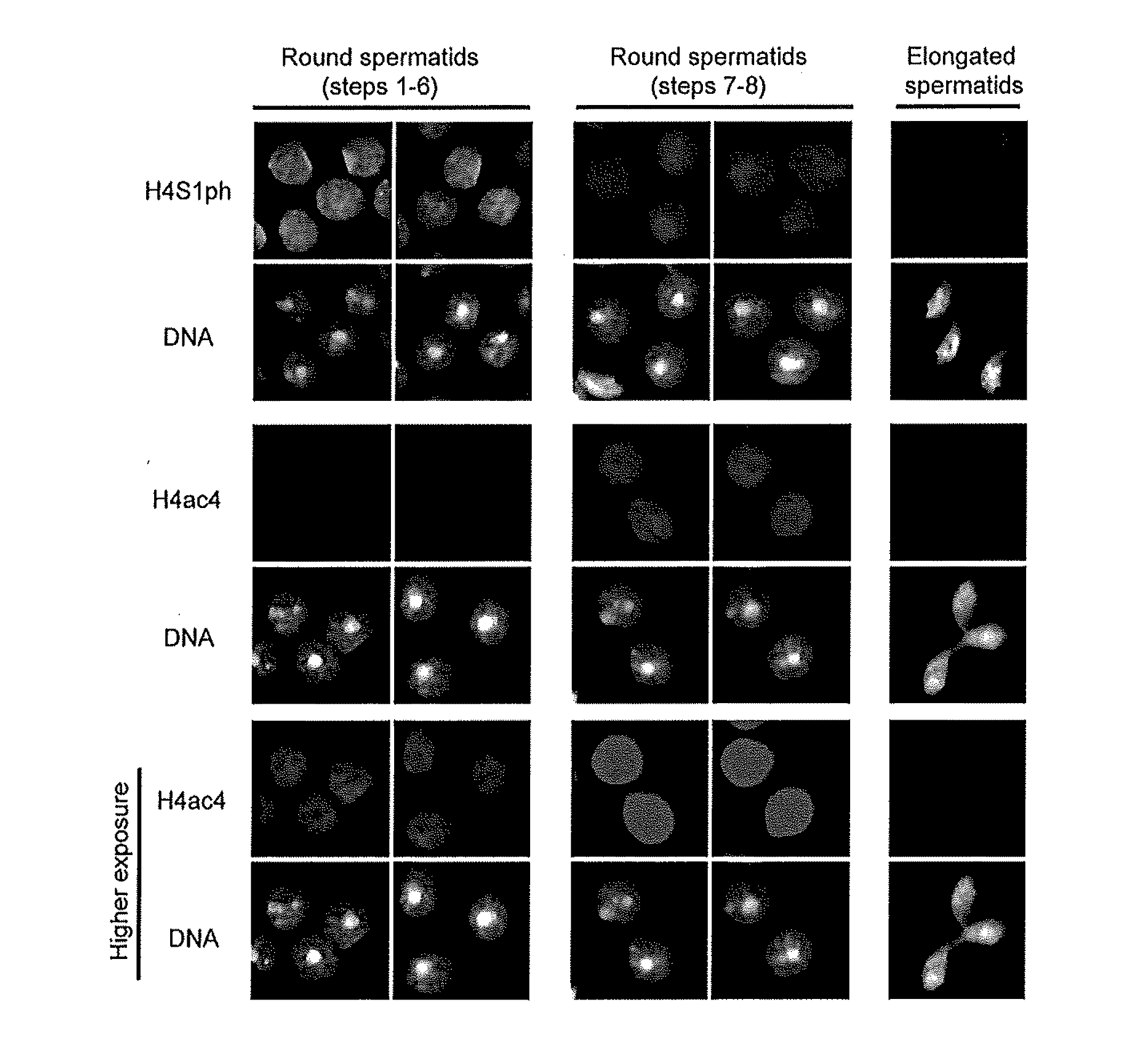 Compositions and Methods for the Identification and Use of Epigenetic Markers Useful in the Study of Normal and Abnormal Mammalian Gametogenesis