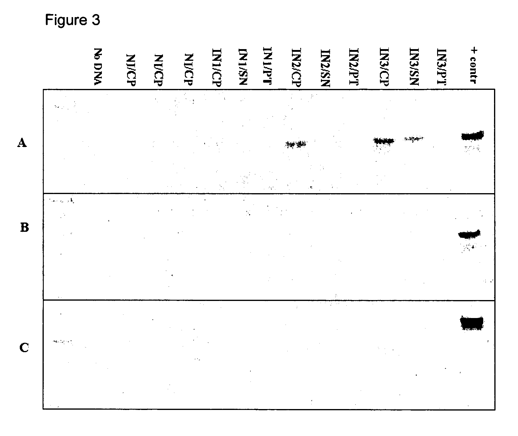 Kits for diagnosis and monitoring of viral infection by analysis of viral transrenal nucleic acids in urine