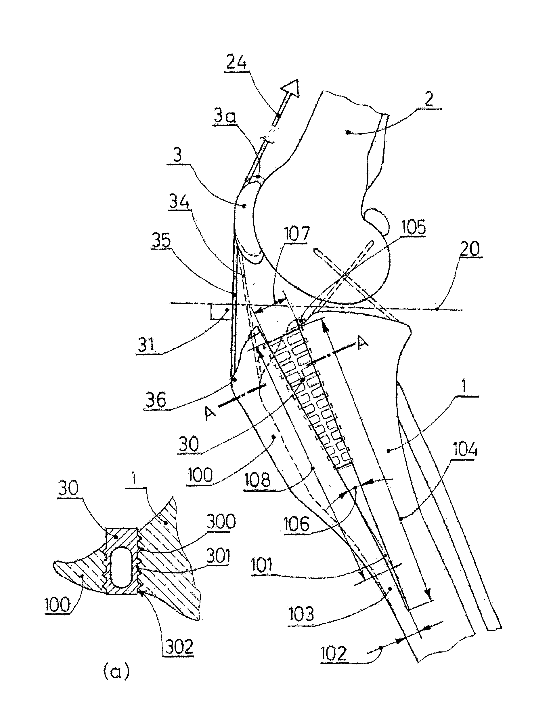 Tibial tuberosity advancement cage for ACL injuries