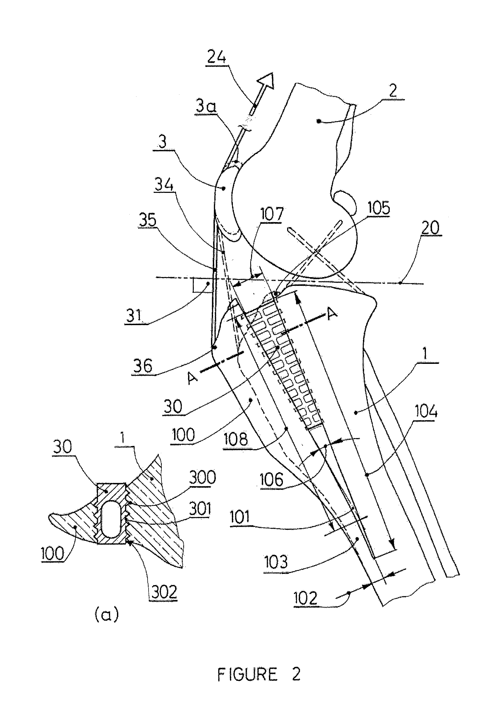 Tibial tuberosity advancement cage for ACL injuries