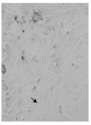 Chicken infectious bursal disease virus ibdv VP2 protein ligand-binding epitope polypeptide and application thereof