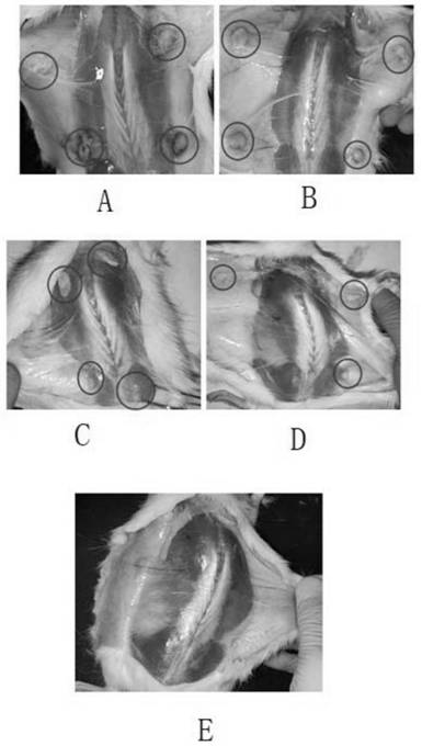 Preparation and application of biological adhesion enhanced temperature-sensitive chitosan-based postoperative adhesion prevention hydrogel