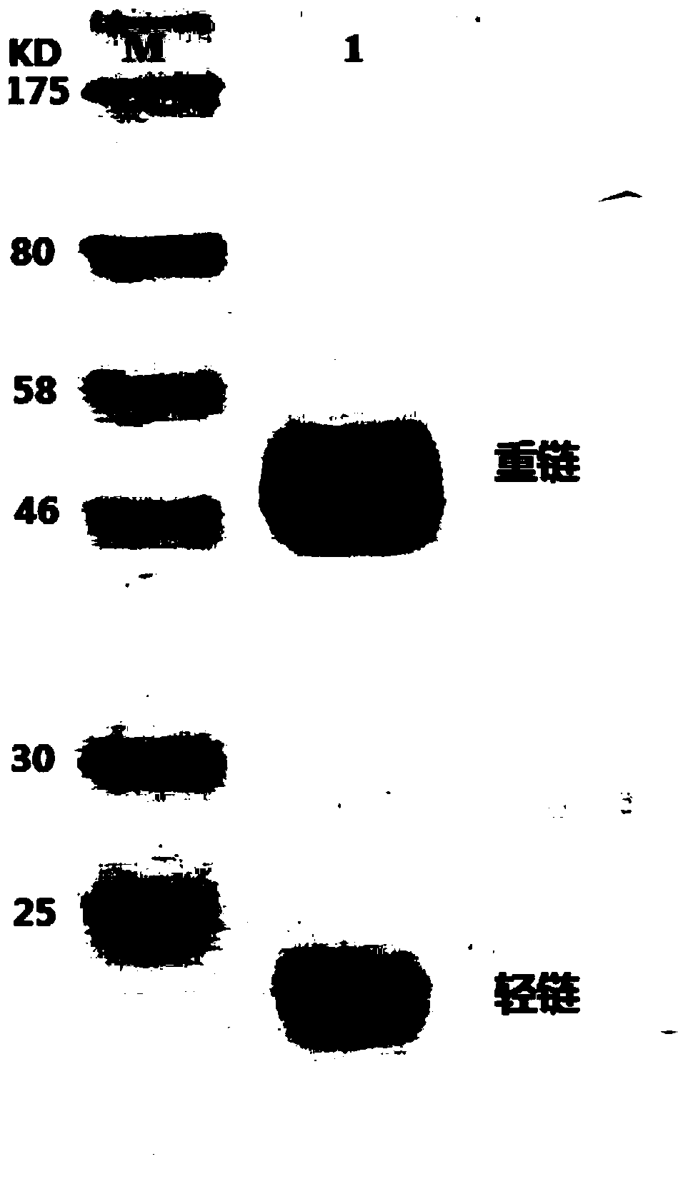 Human mycoplasma pneumoniae monoclonal antibody and its application