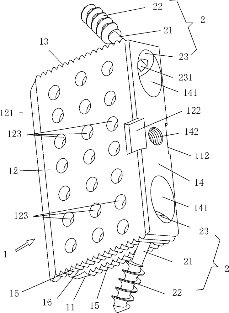 Lumbar interbody fusion device