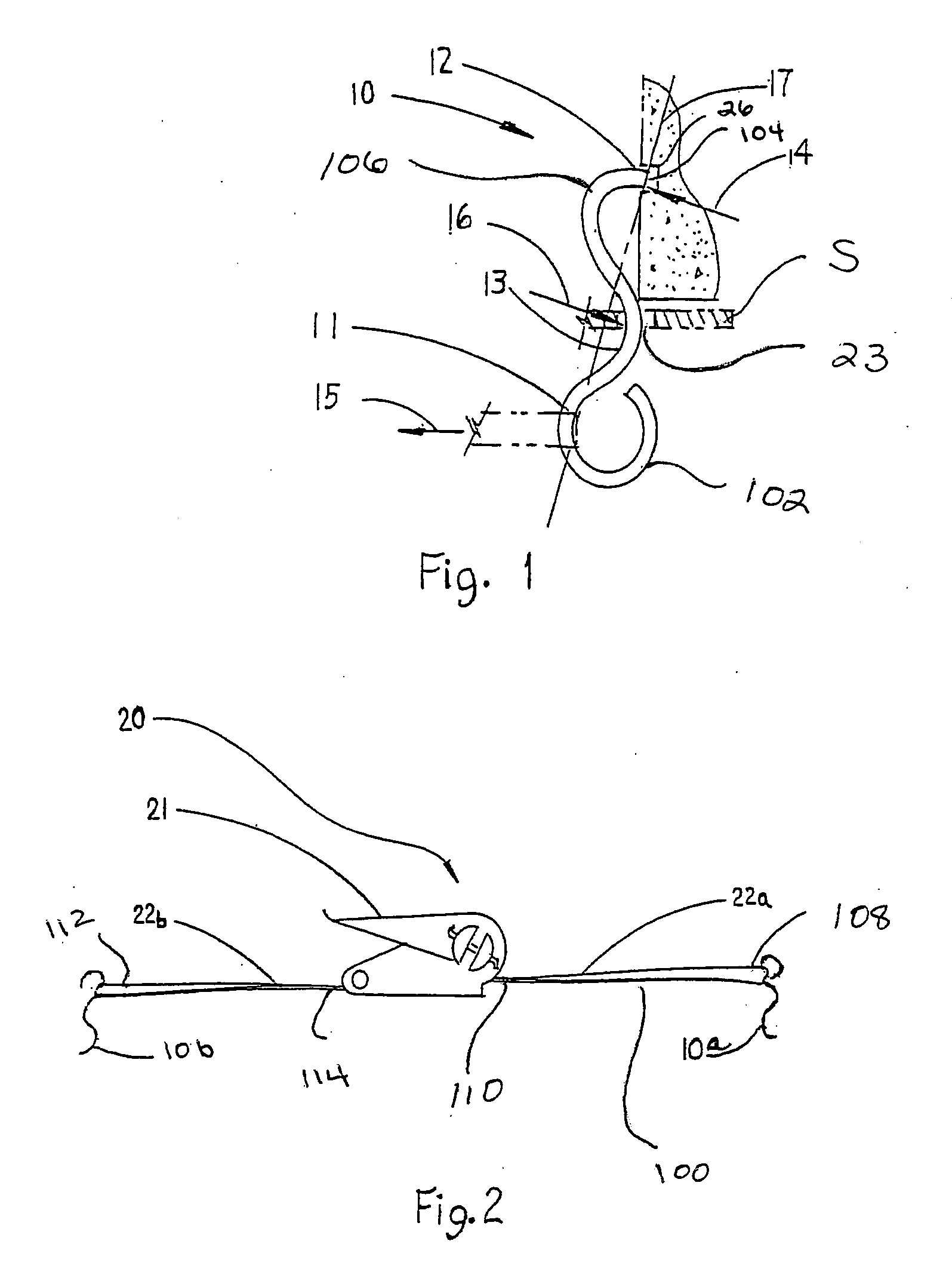 Universal attachment assembly for clamping and bracing covers over openings