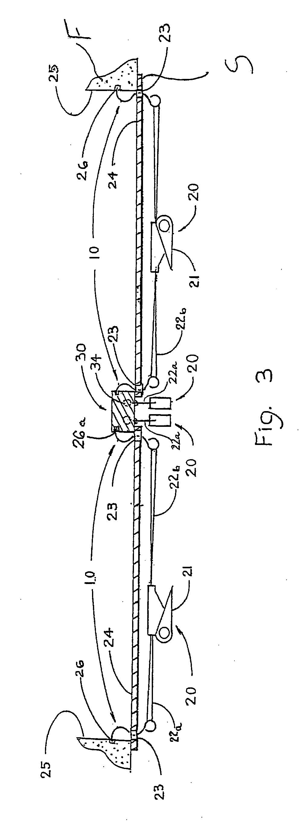 Universal attachment assembly for clamping and bracing covers over openings