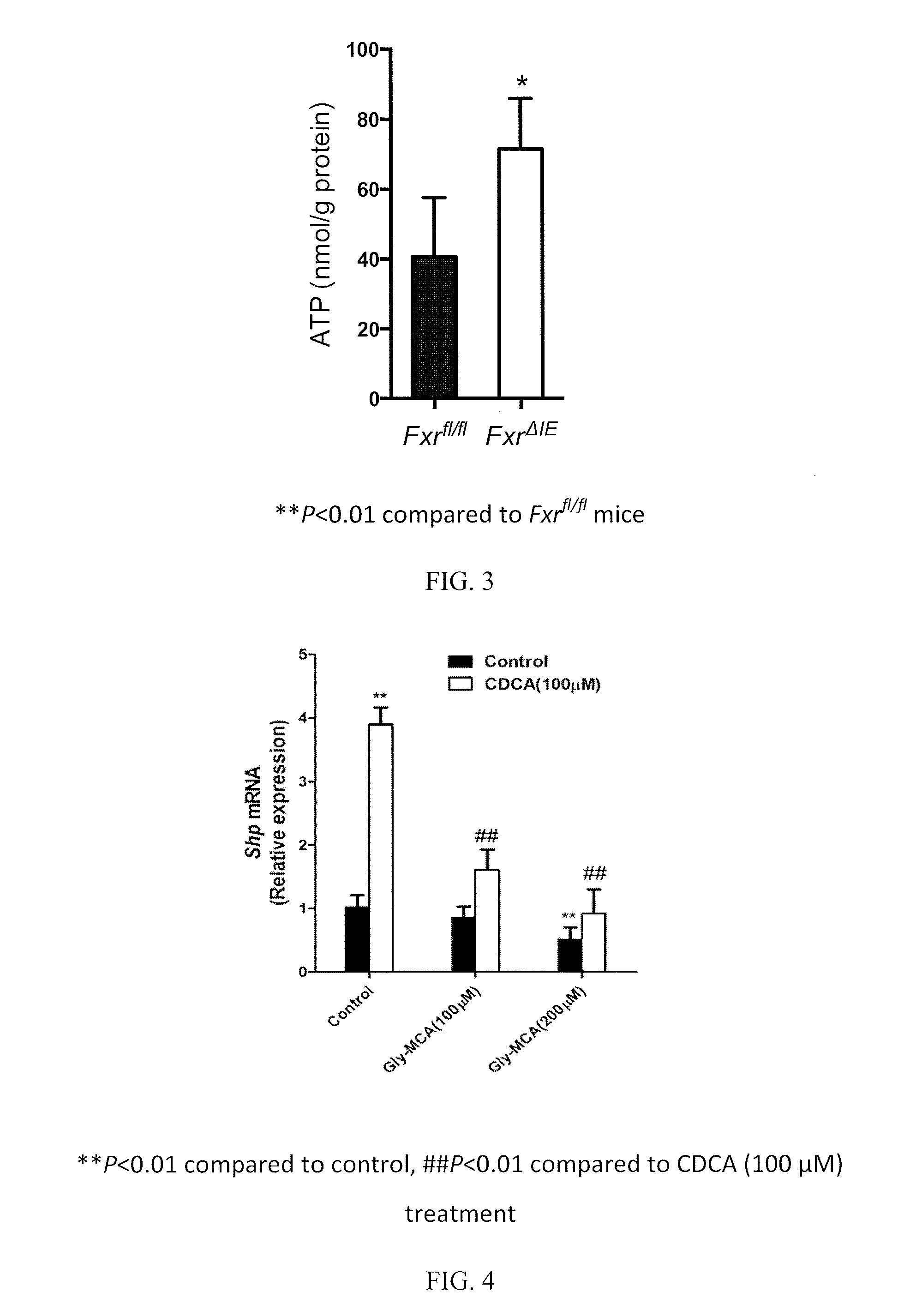 Inhibitors of the farnesoid x receptor and uses in medicine