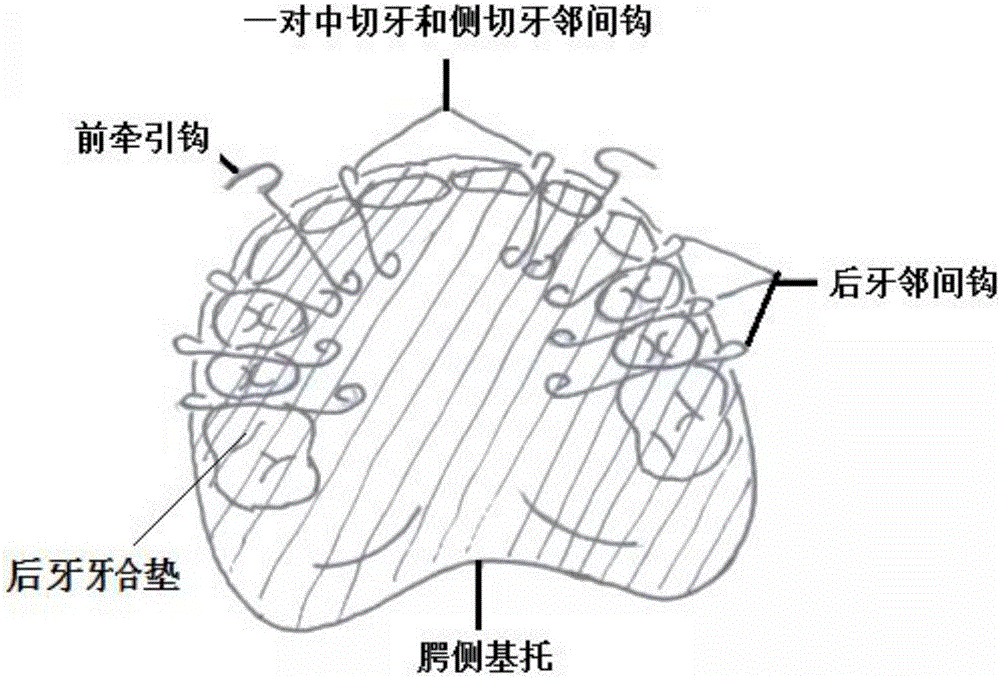 Intraoral maxillary clasp type occlusal pad reverse headgear appliance for orthodontics of skeletal crossbite