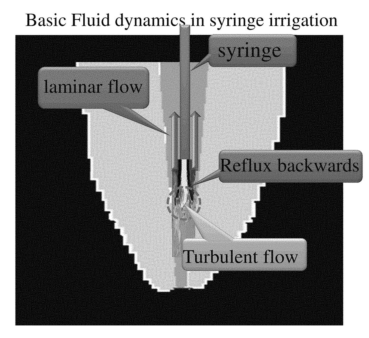 Activated micro-bubble based root canal disinfection