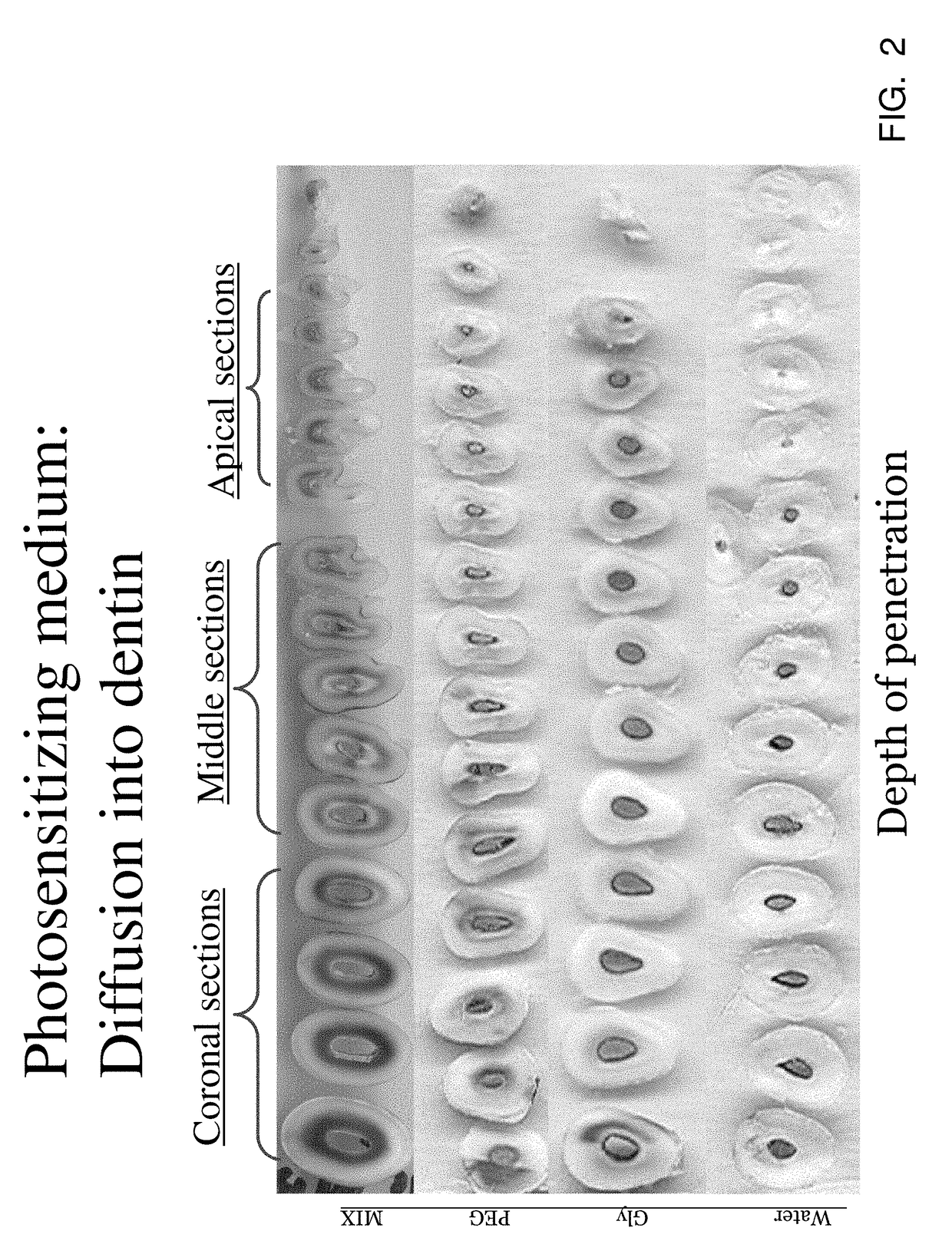 Activated micro-bubble based root canal disinfection