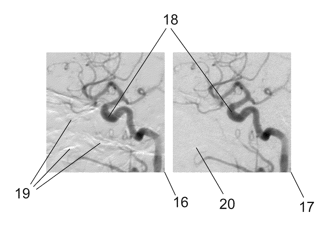 Method for acquisition of subtraction angiograms