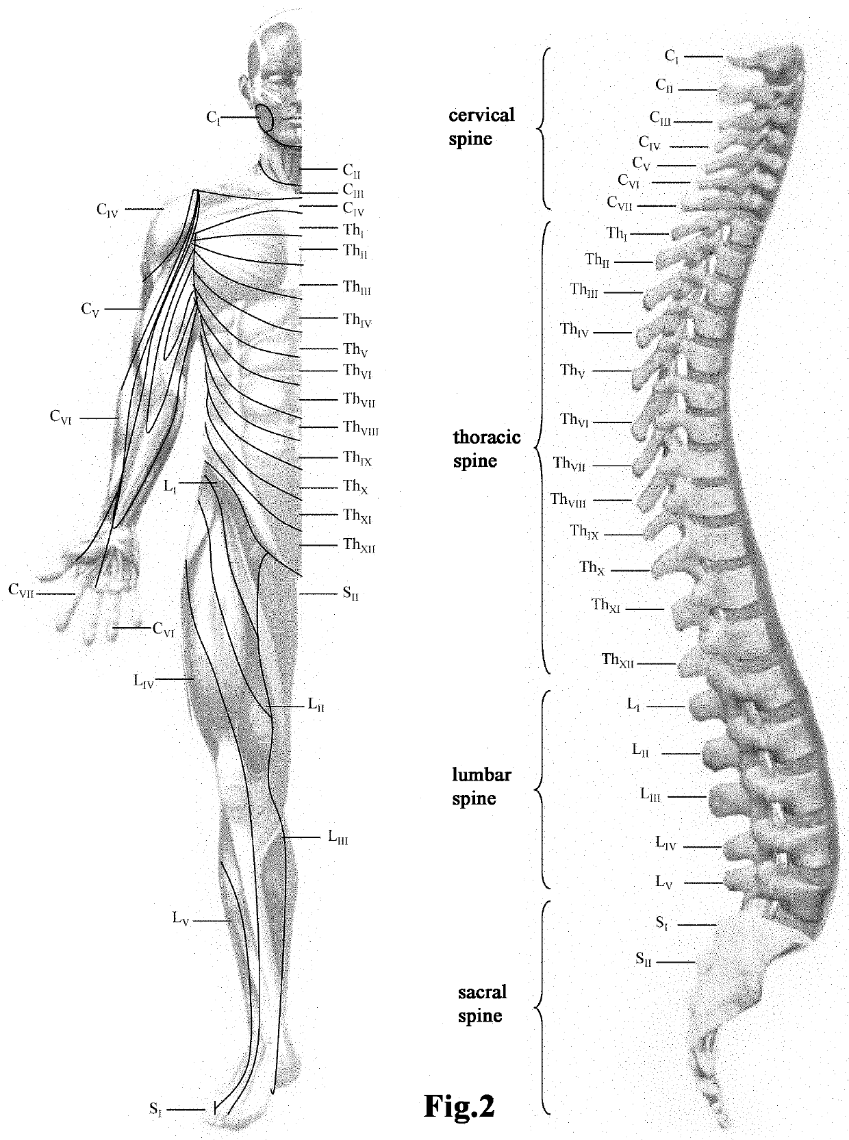 Method for Relaxing Spasmed Muscles