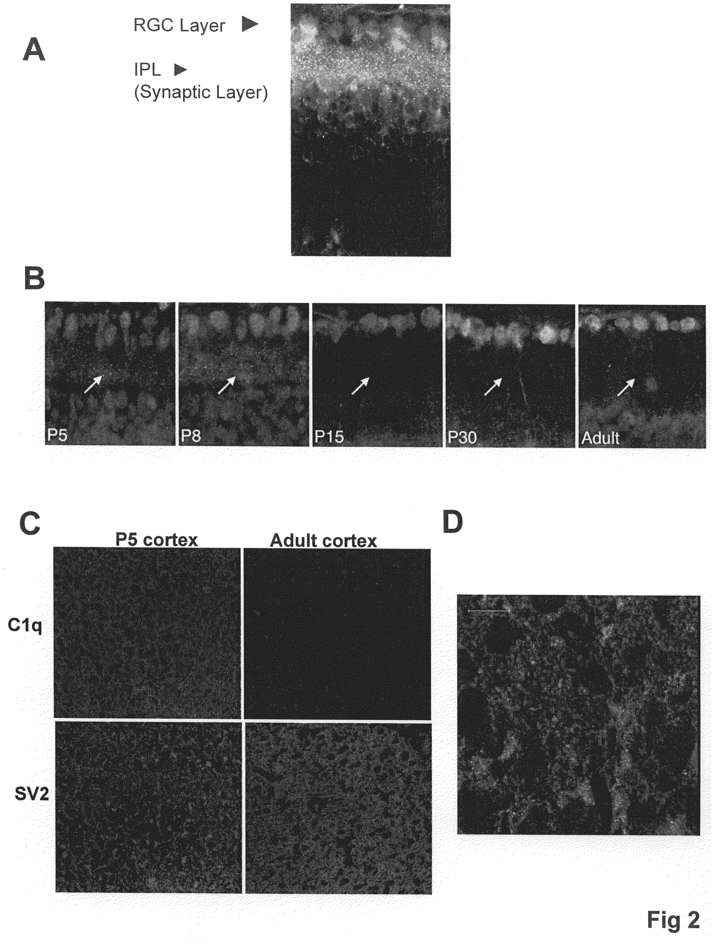 Modulation of synaptic maintenance