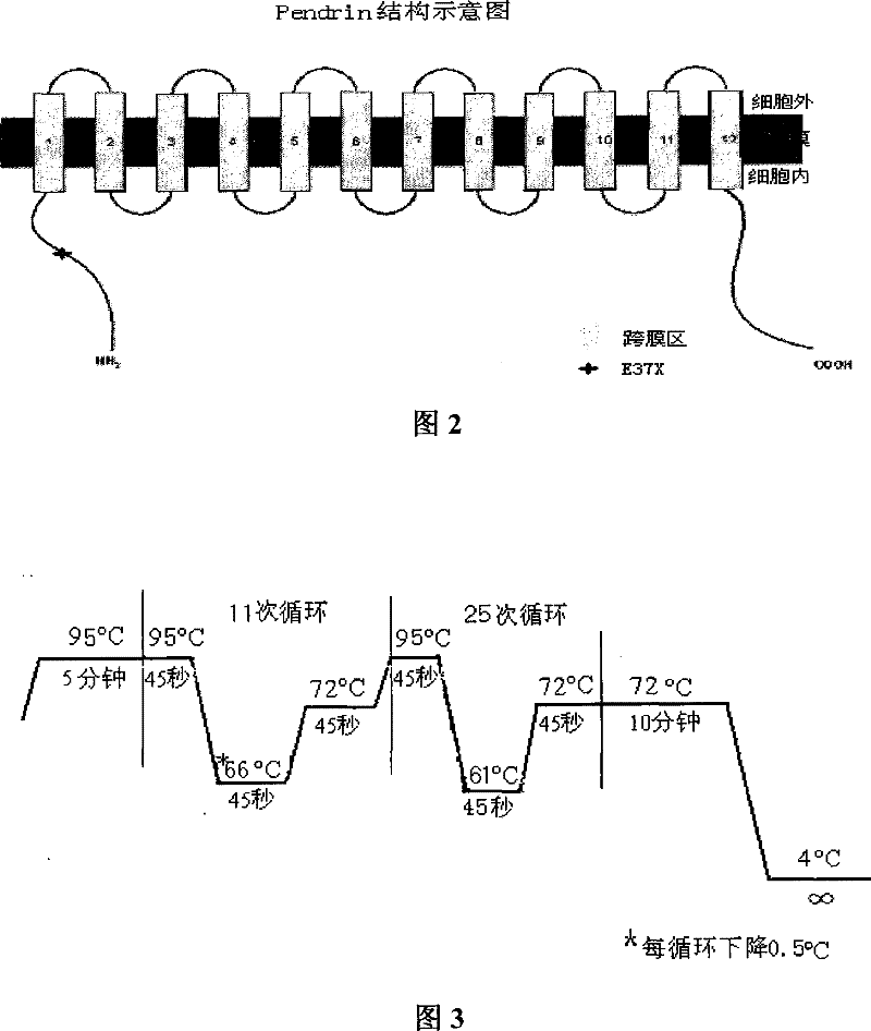 Reagent case for detecting 589G &gt;A mutation of large vestibular aqueduct related gene SLC26A4