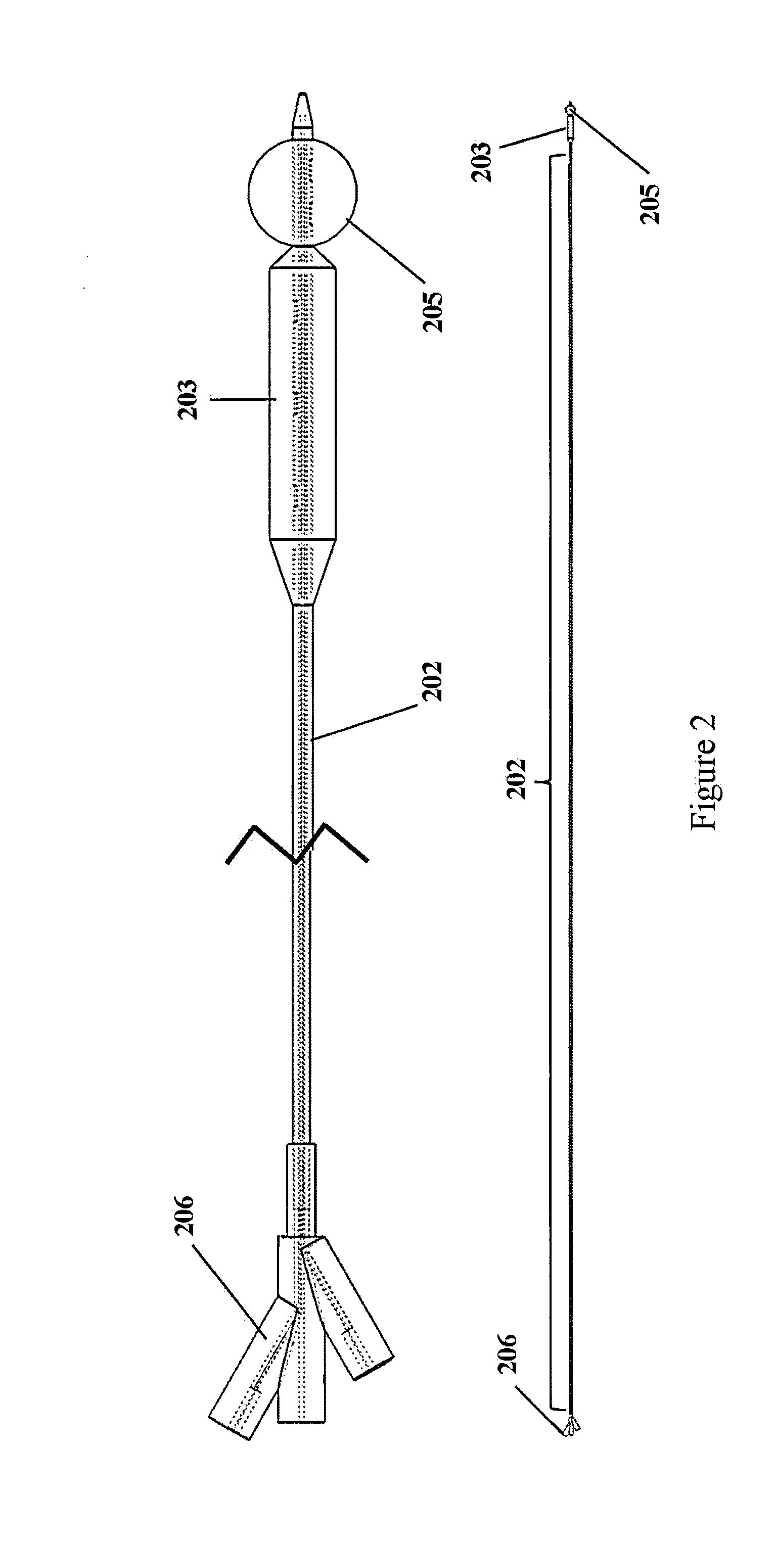 Endopyloric tool and method to treat hypertropic pyloric stenosis