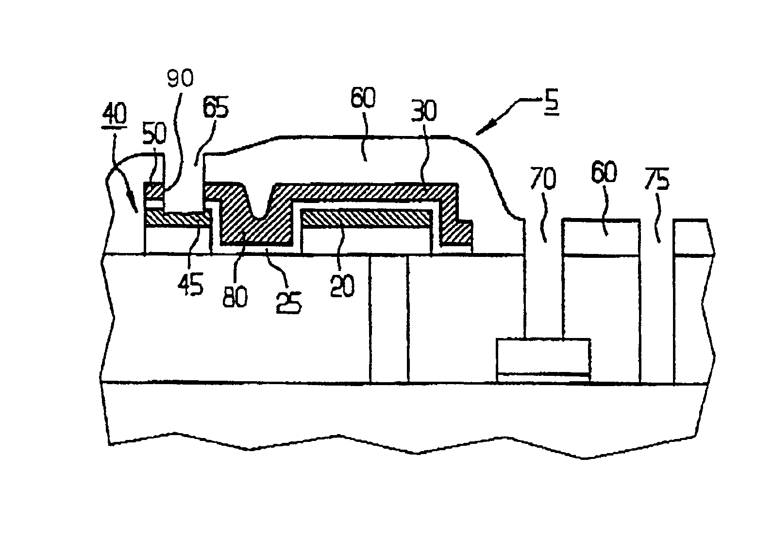 Semiconductor component having a material reinforced contact area