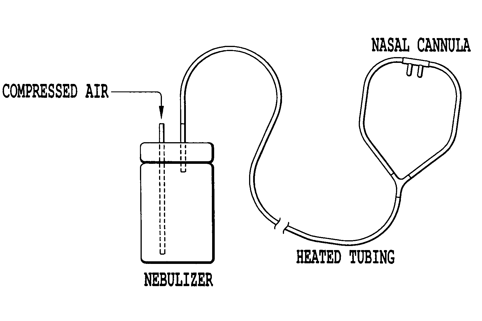 Inhaled hypertonic saline delivered by a heated nasal cannula