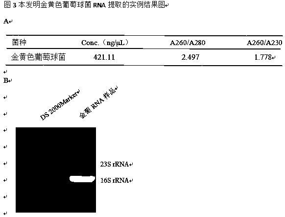 Efficient and stable bacterium total RNA (Ribonucleic Acid) extraction method