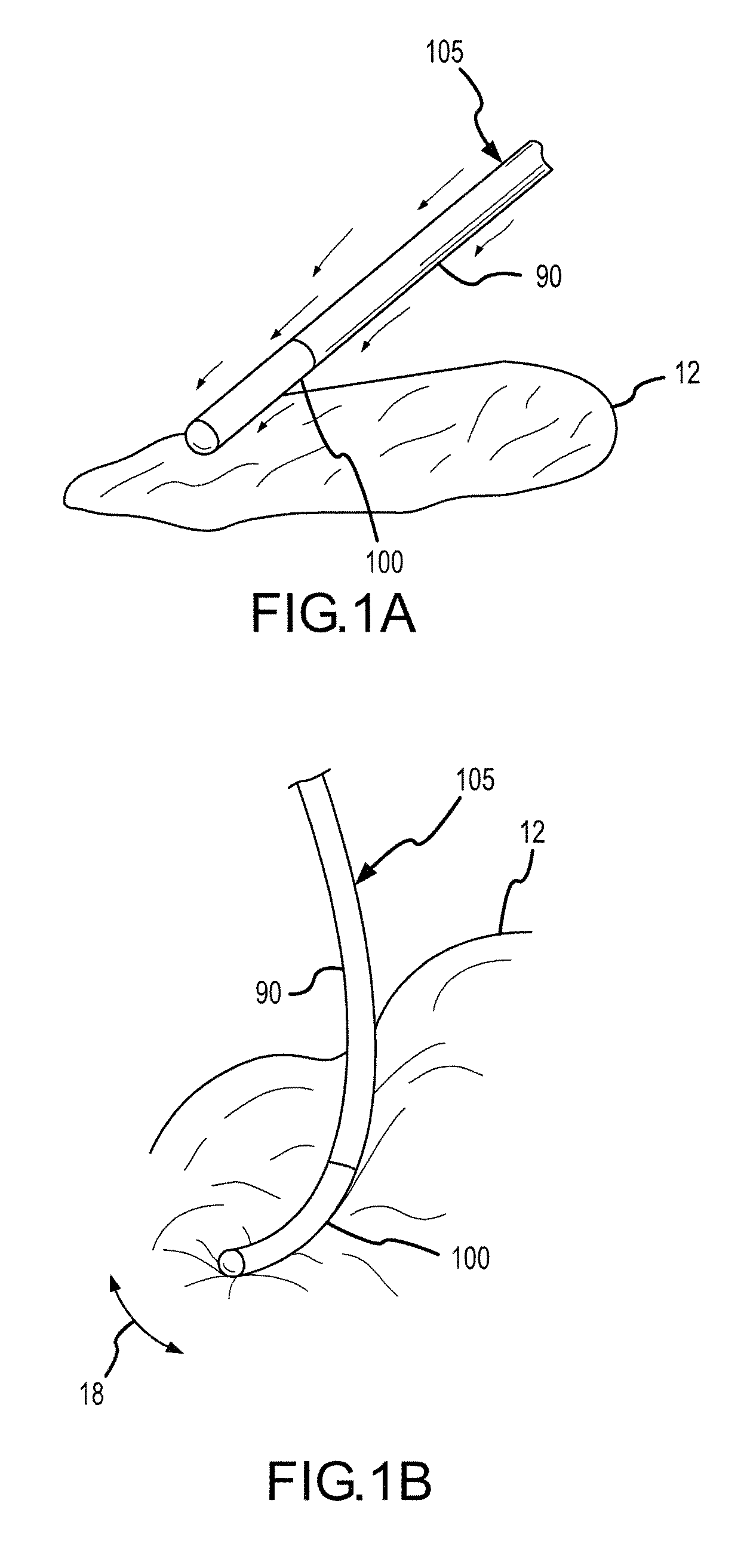 Flexible conductive polymer electrode and method for ablation