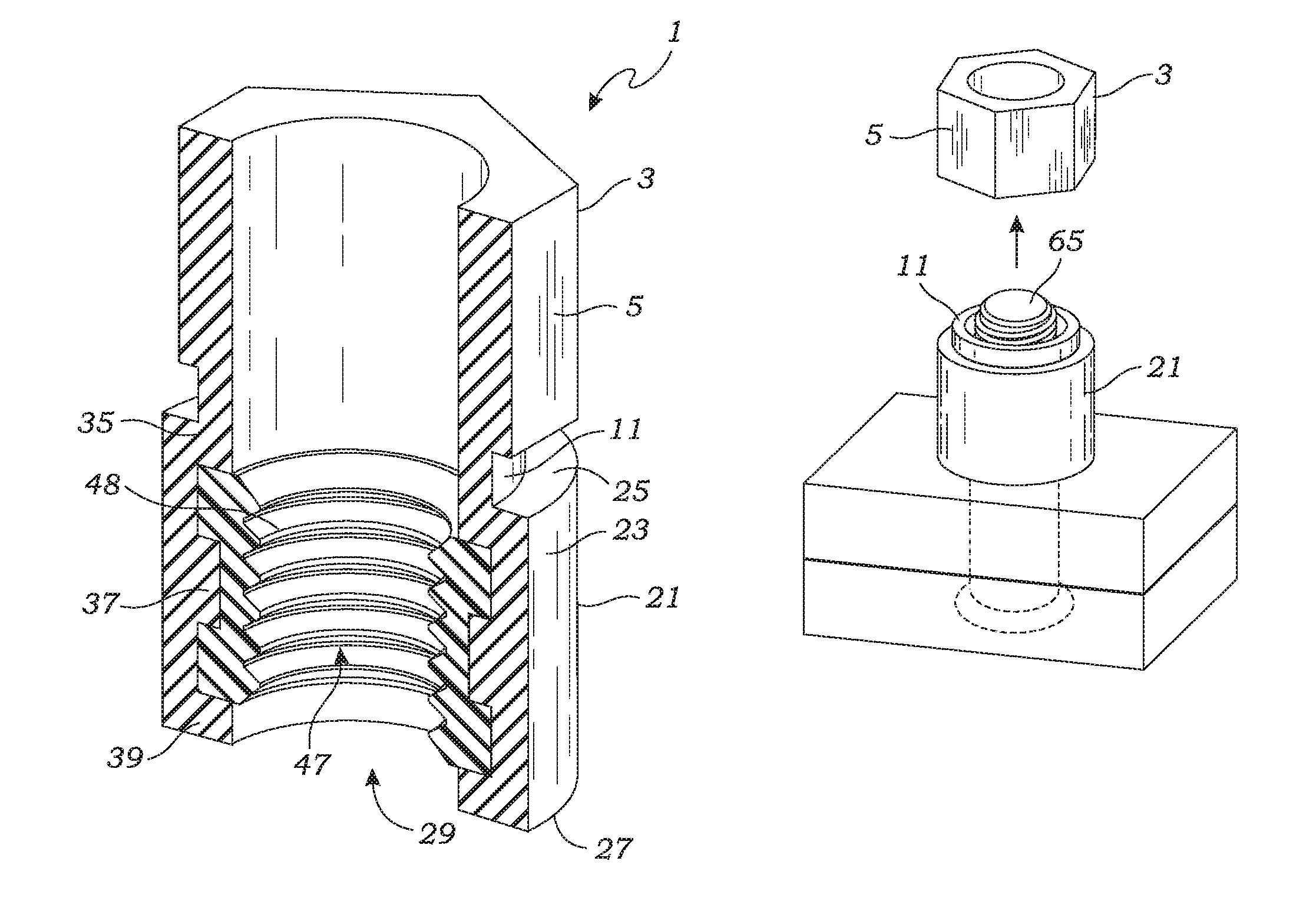 Hybrid composite-metal breakaway nut fastener