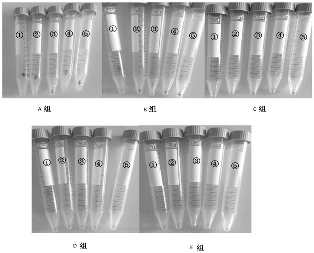 Method for extracting thrombus exosome of patient with acute myocardial infarction and application of thrombus exosome