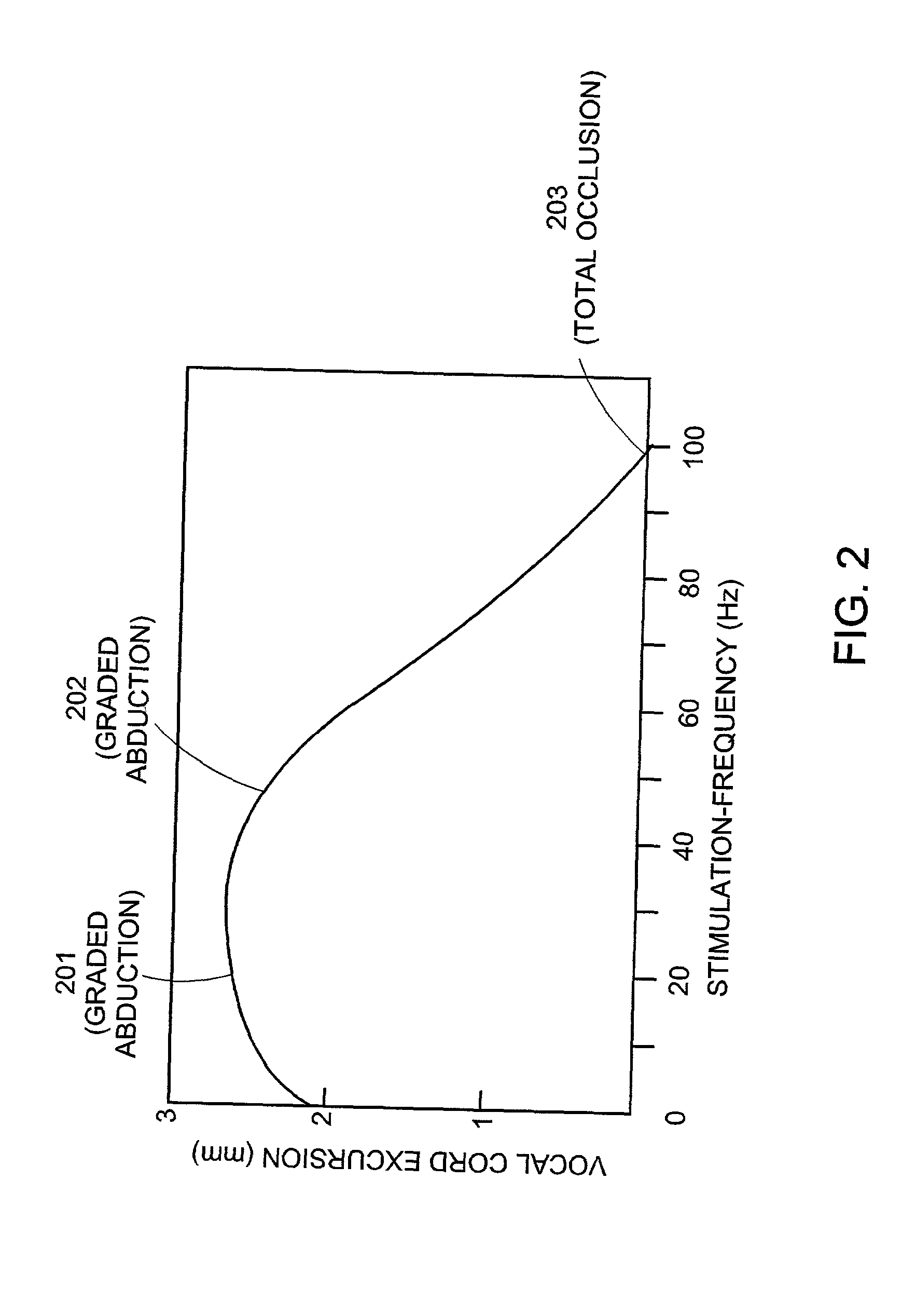 Pacemaker for bilateral vocal cord autoparalysis