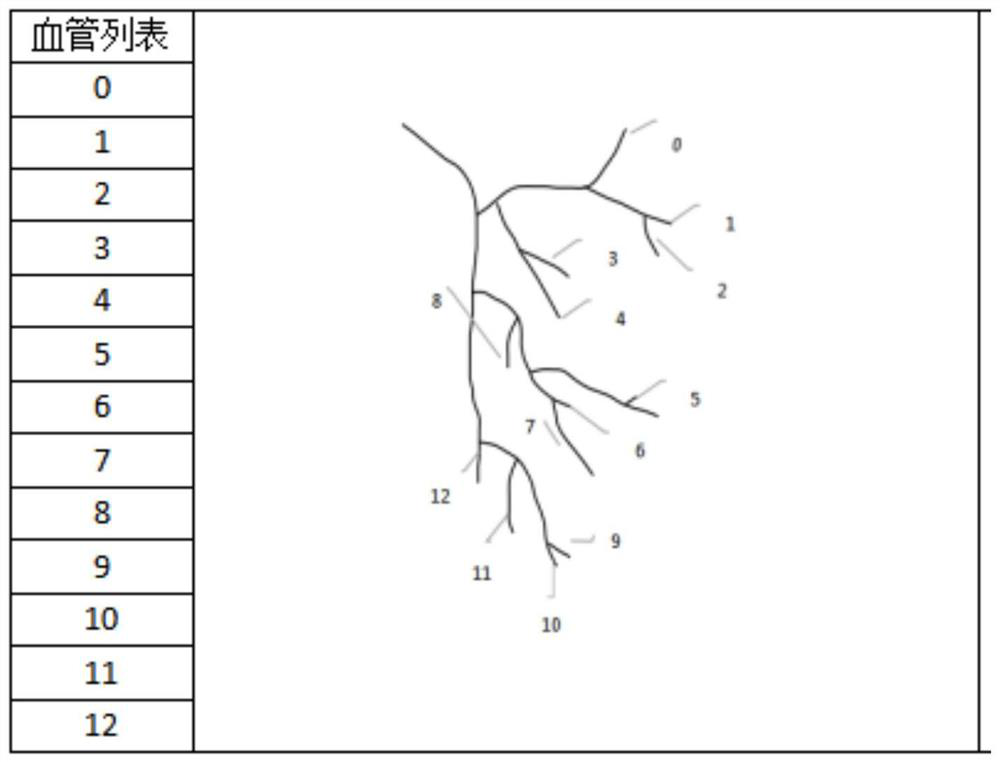 Vascular sorting method based on pulmonary artery CT images