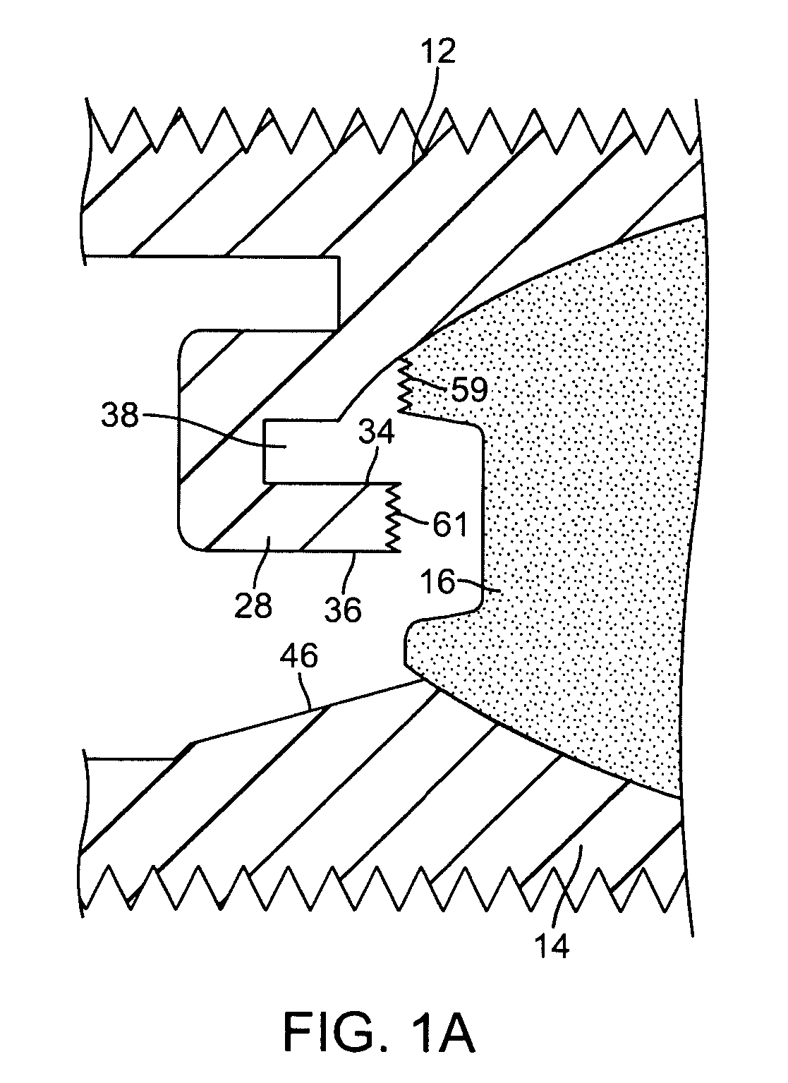 Intervertebral prosthetic disc with metallic core